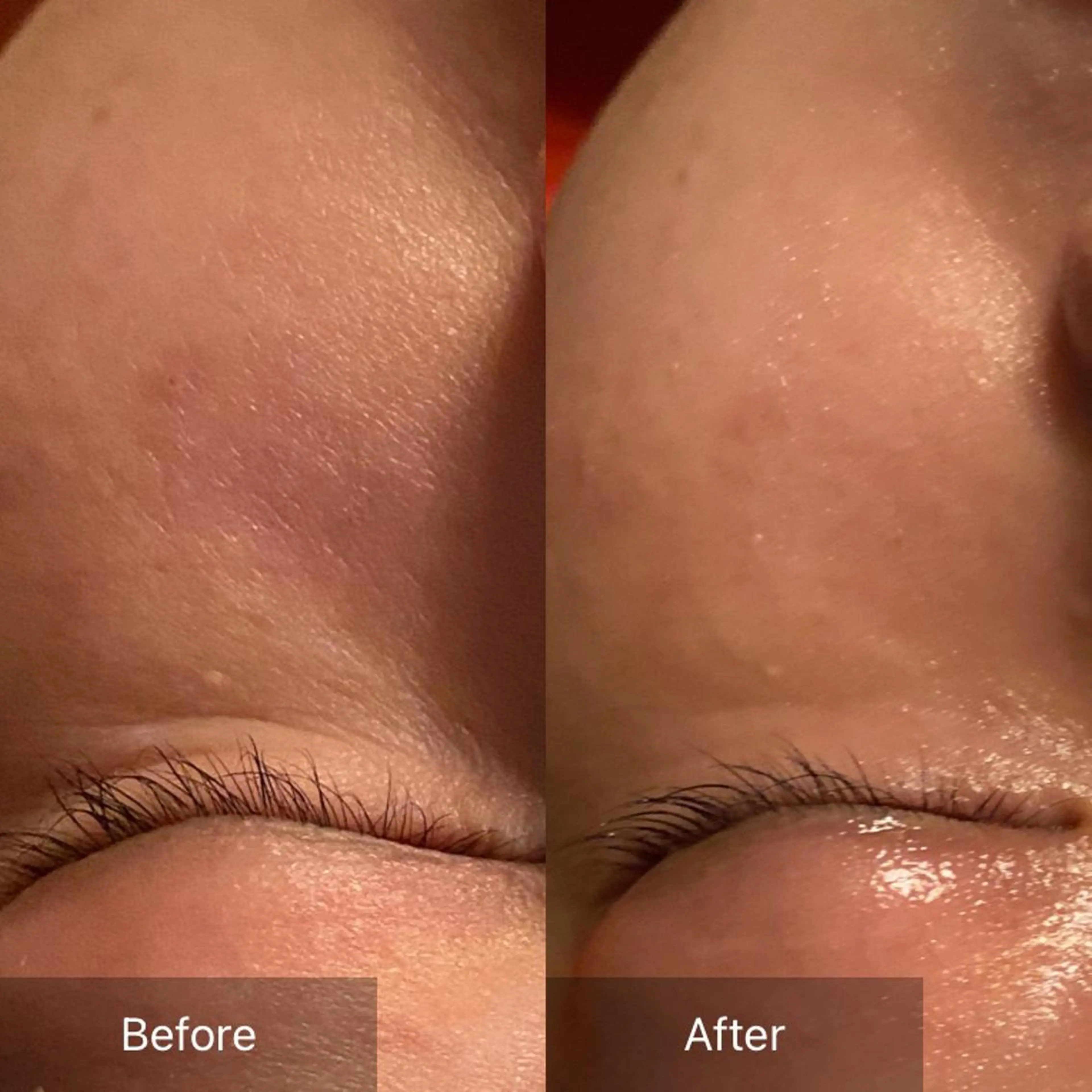 Mandarin Orange所属・毛穴から始める肌メン テマンダリンオレンジのエステ・リラクイメージ