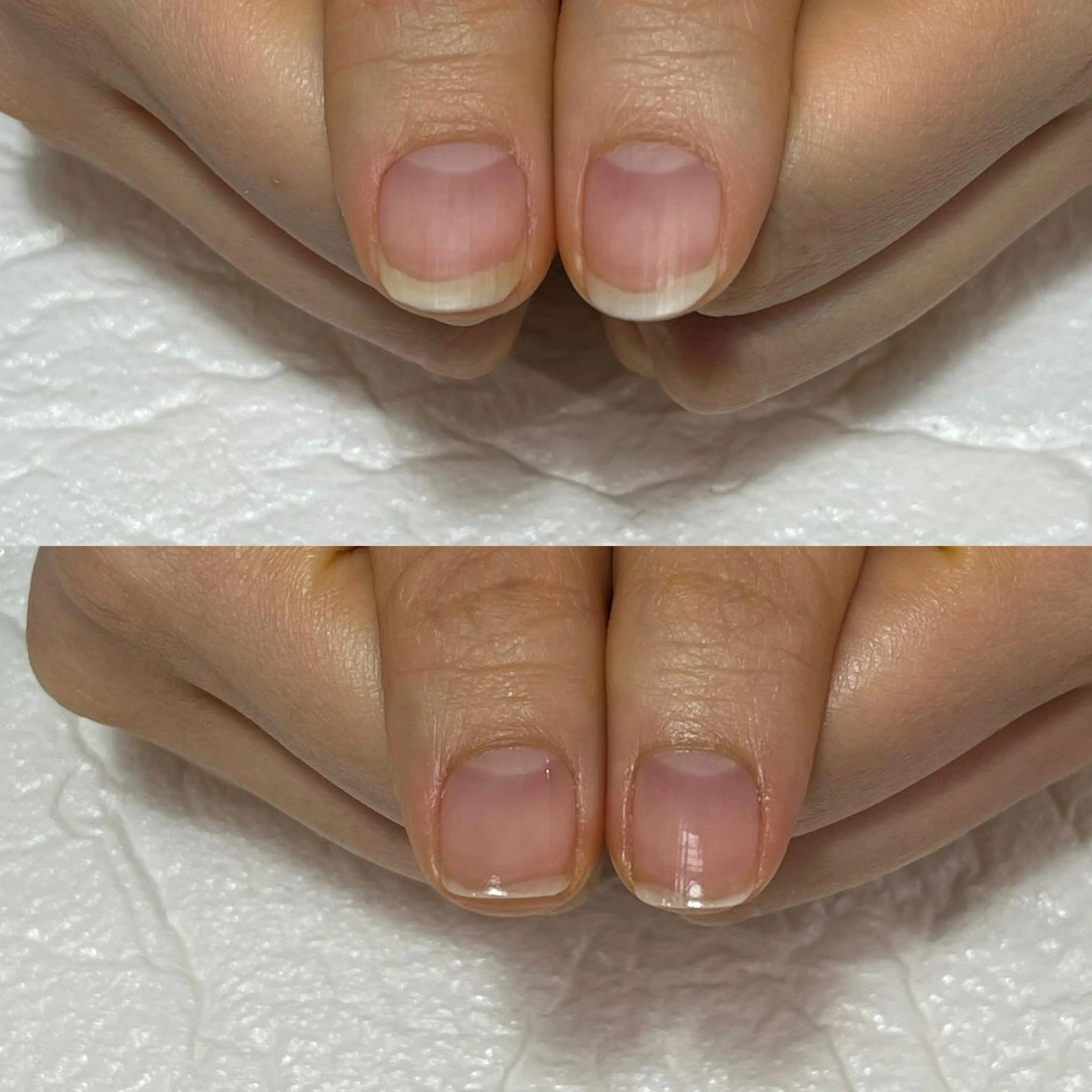 ネイル 自爪育成・巻き爪 補正講師　津蔵のネイルデザイン