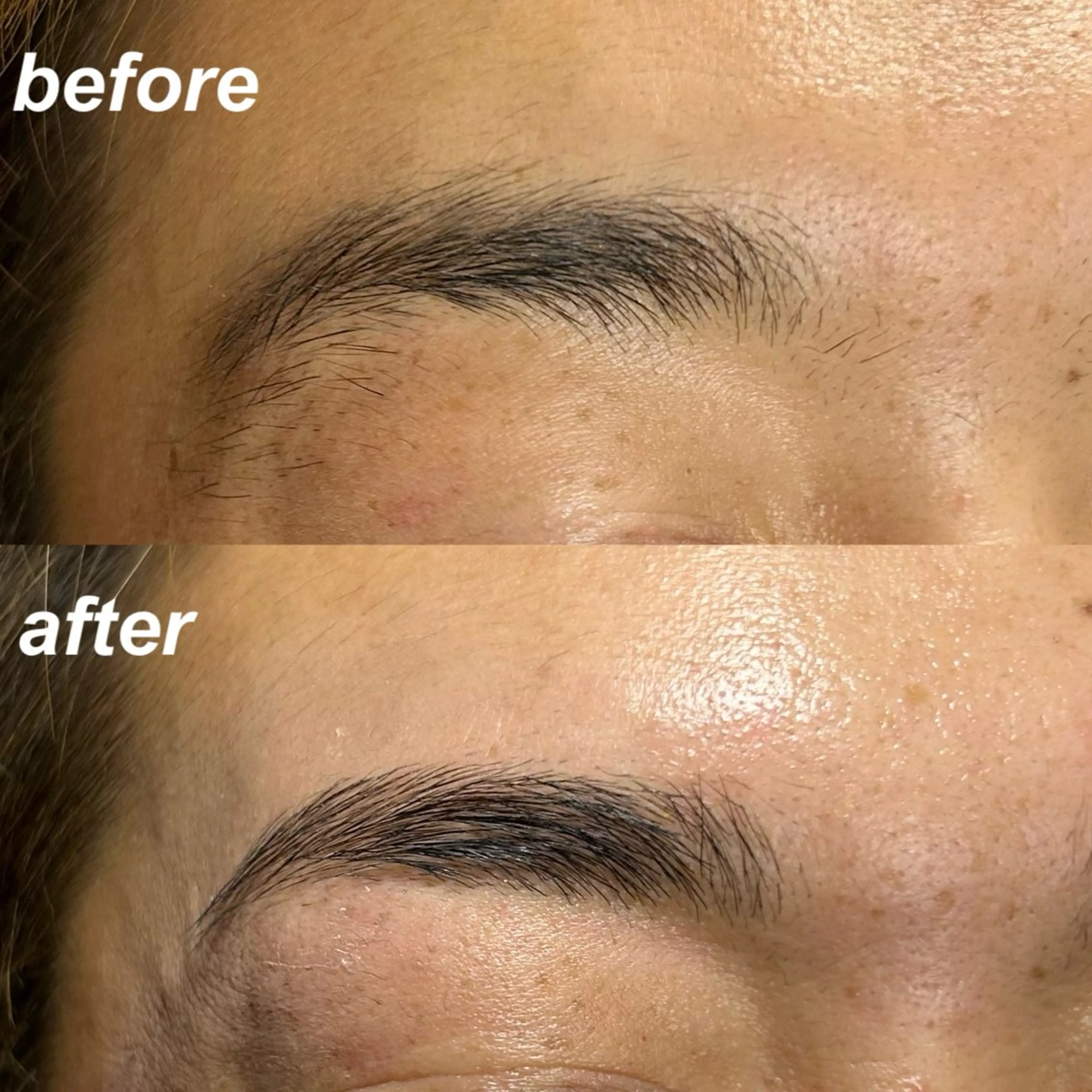 【メンズモテ美眉】ハリウッドブロウリフト＋ひげ脱毛の写真