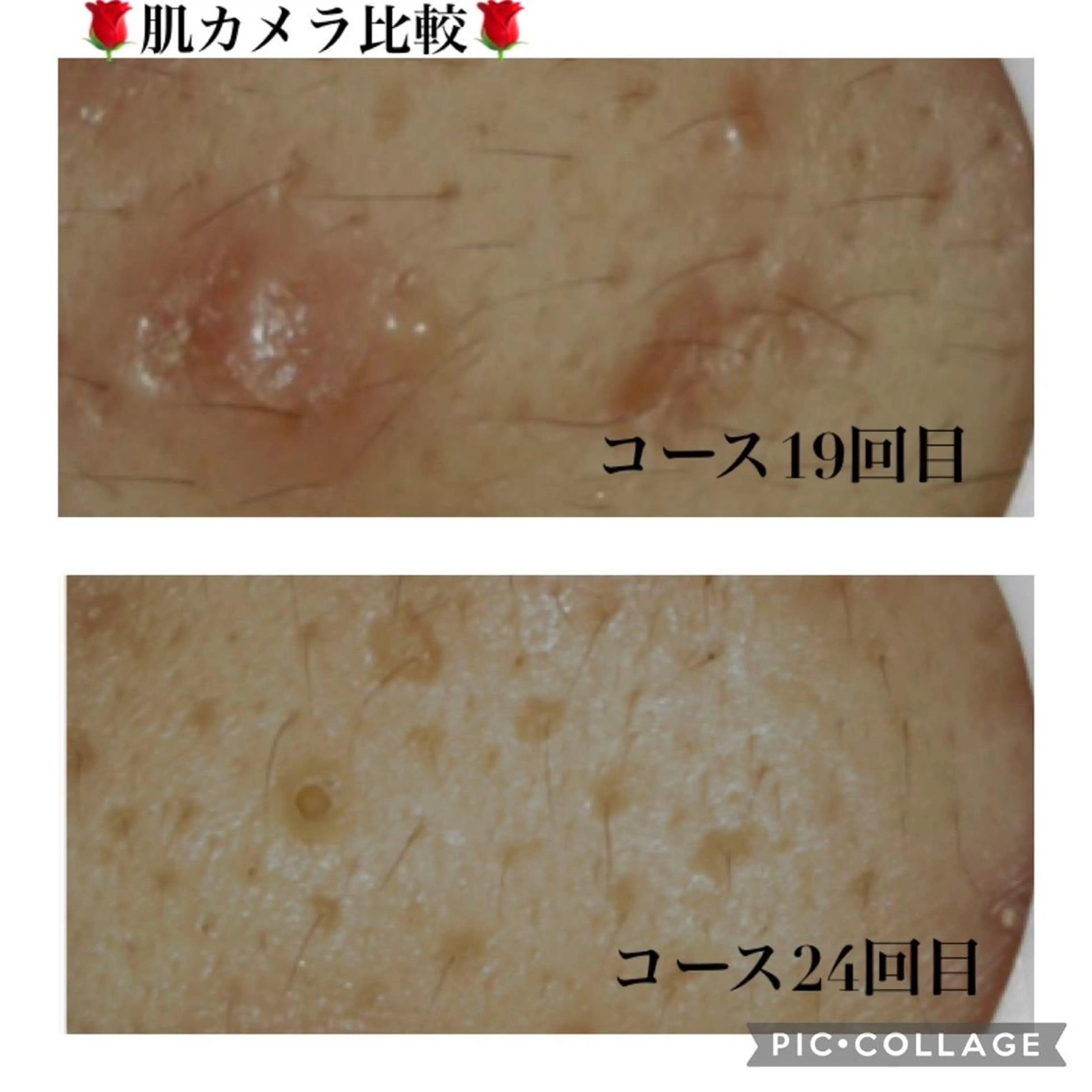 触れたくなる モテ肌へ...❤︎のエステ・リラクイメージ