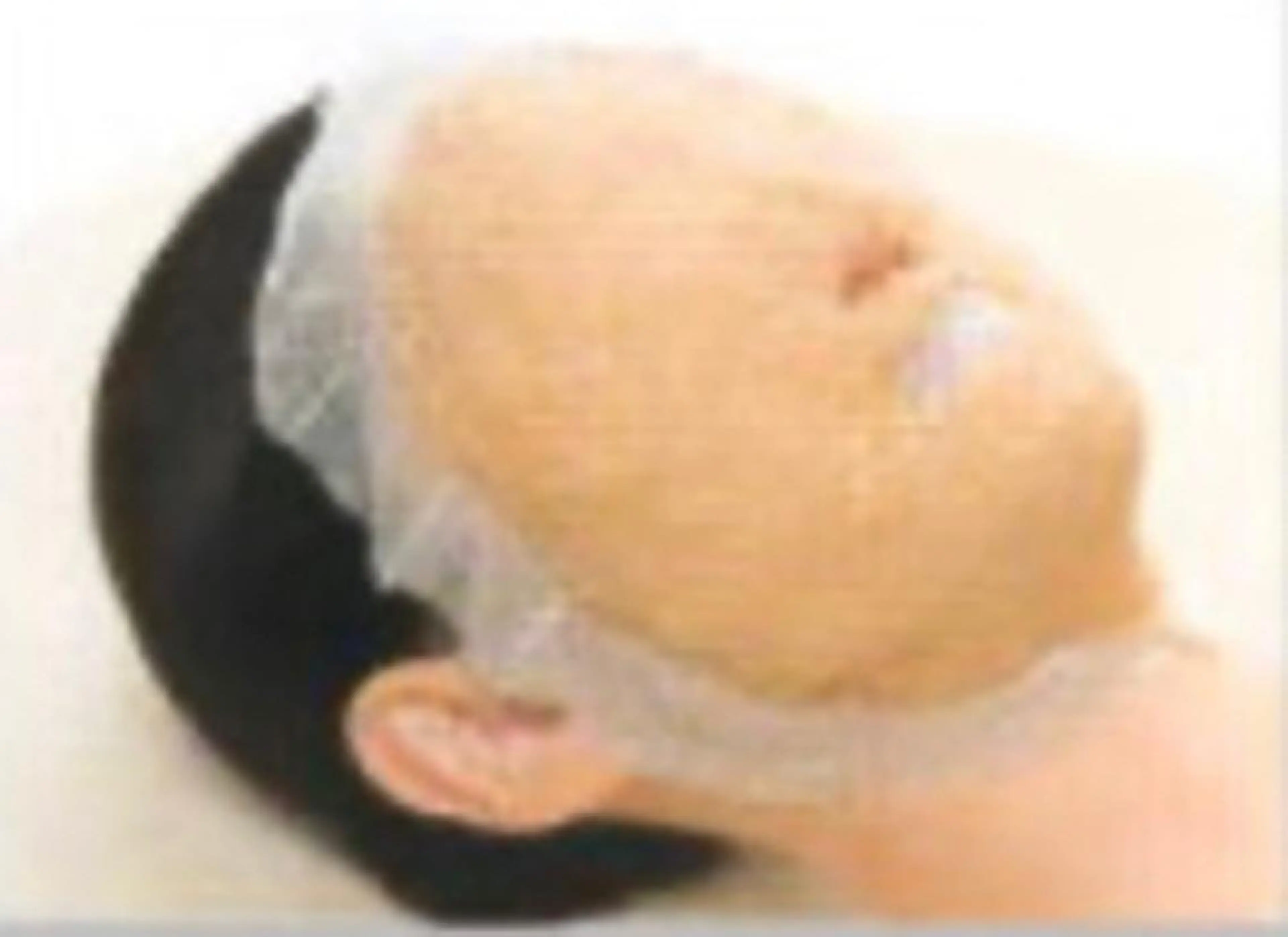 \敏感肌荒れ専用コース⚠️/季節変わり目や肌荒れが気になる方へ😷肌診断で不調がわかれば解決が早いことも🙆‍♀️の写真