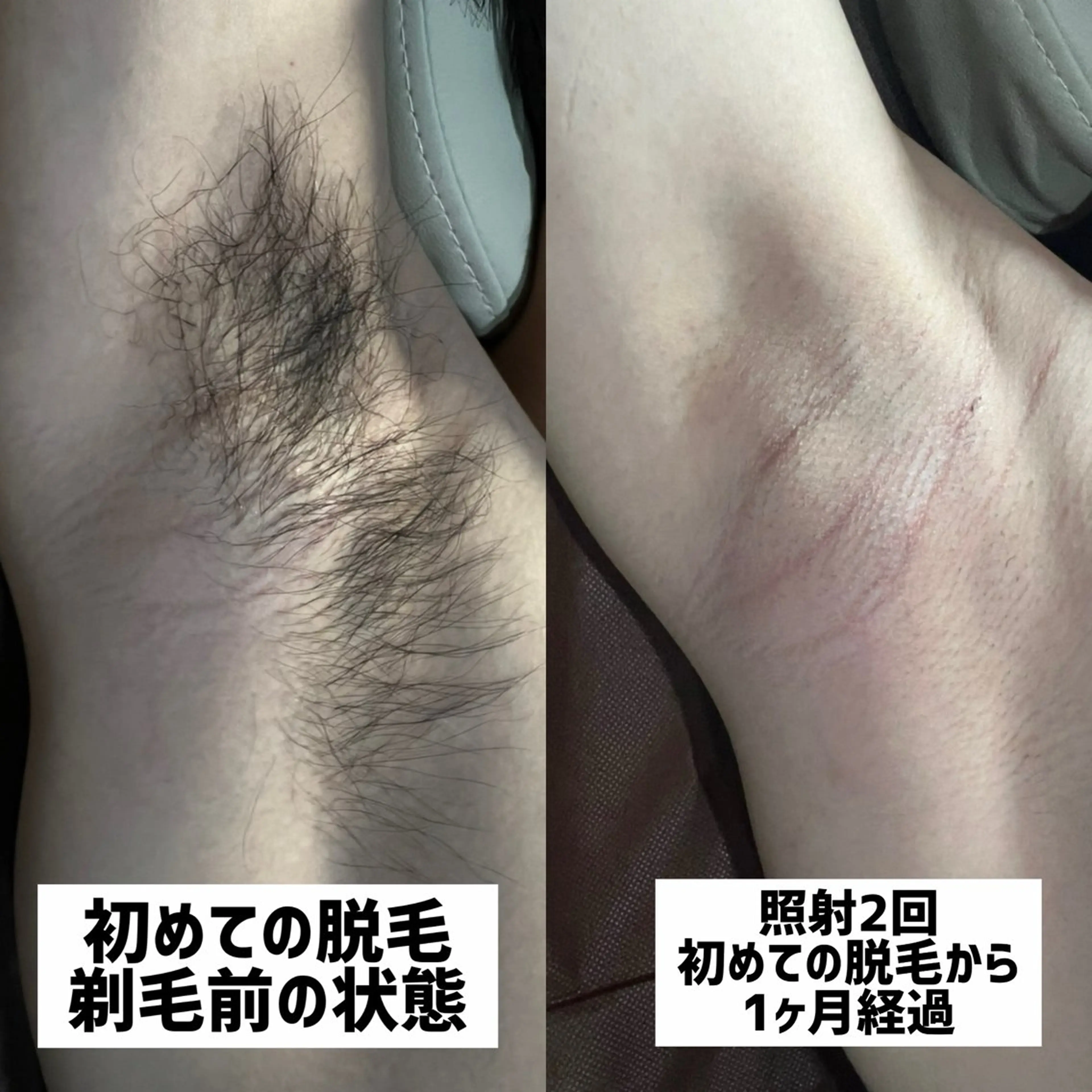 脱毛 Mr.&Ms. 脱毛 /眉毛ワックス/まゆのエステ・リラクイメージ