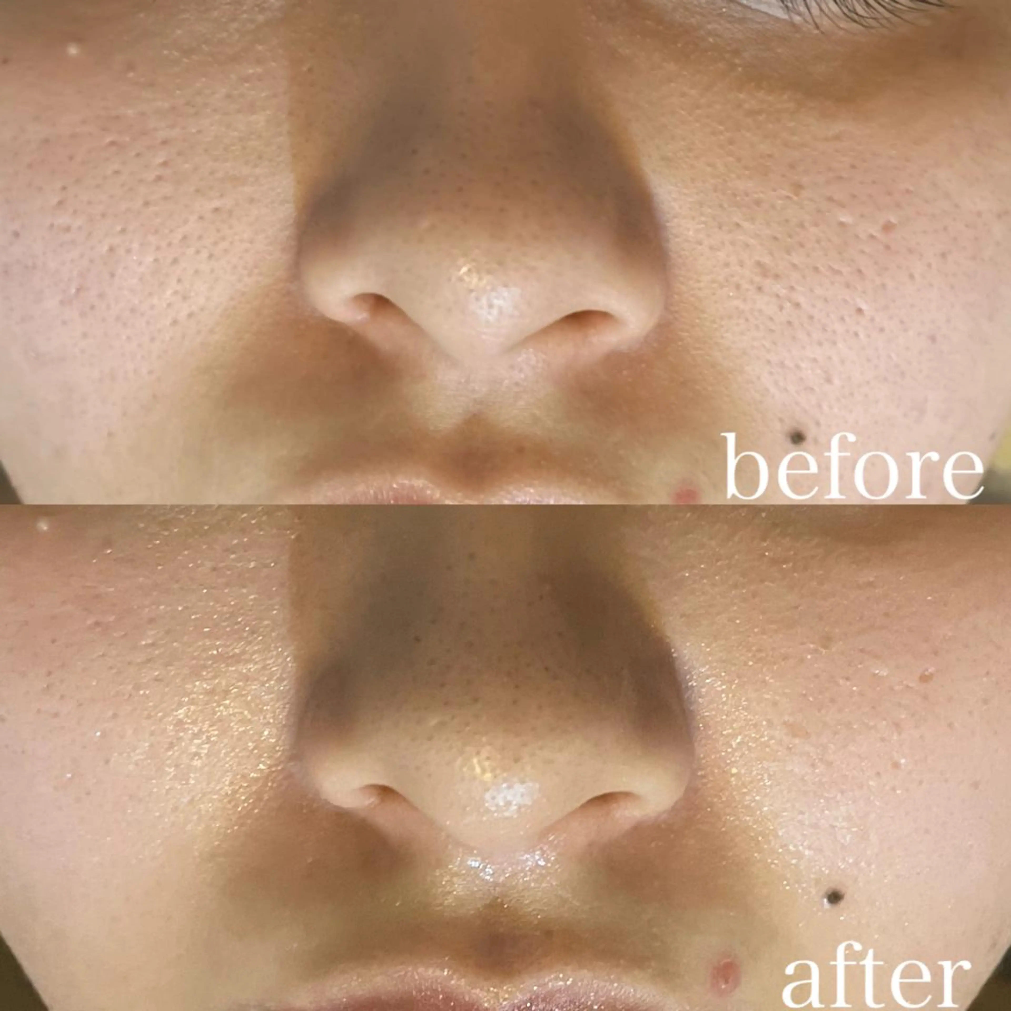 お肌に透明感を♪くすみに◎小顔コルギ+頭蓋骨調整&石膏パック 110分コースの写真