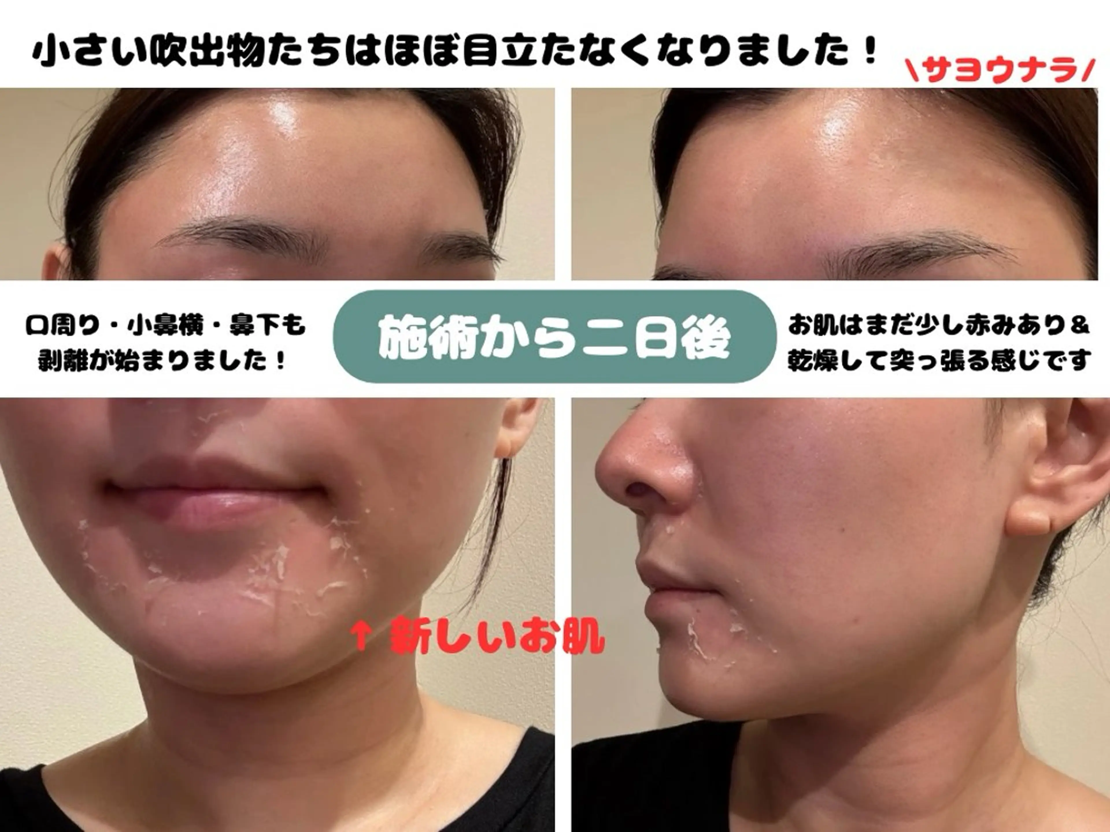 VIKI BEAUTY  クレイハーブピーリング・美肌脱毛専門店所属・VIKI BEAUTYのエステ・リラクイメージ