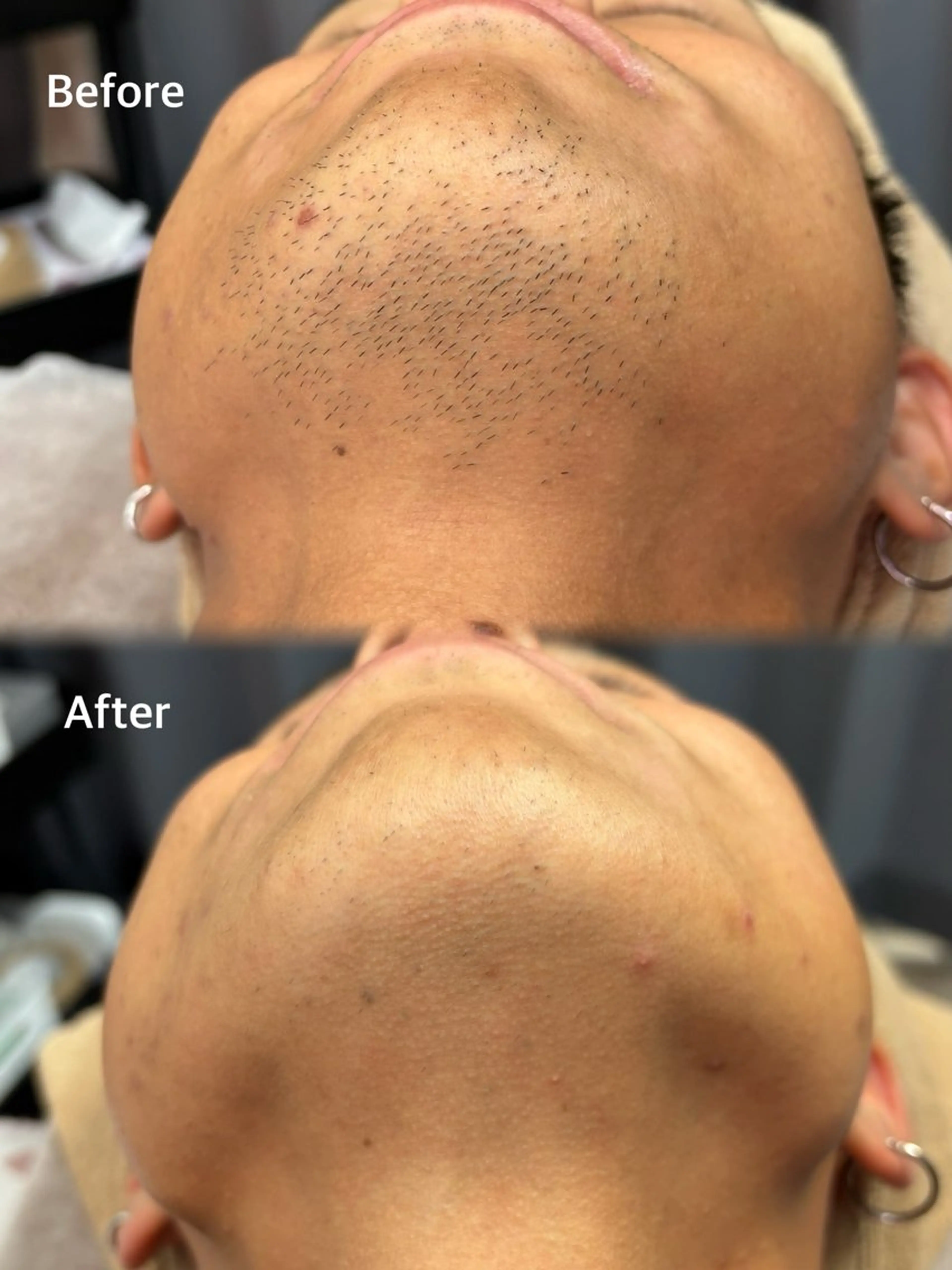 メンズ BELXIA所属・井櫻 玲香のエステ・リラクイメージ