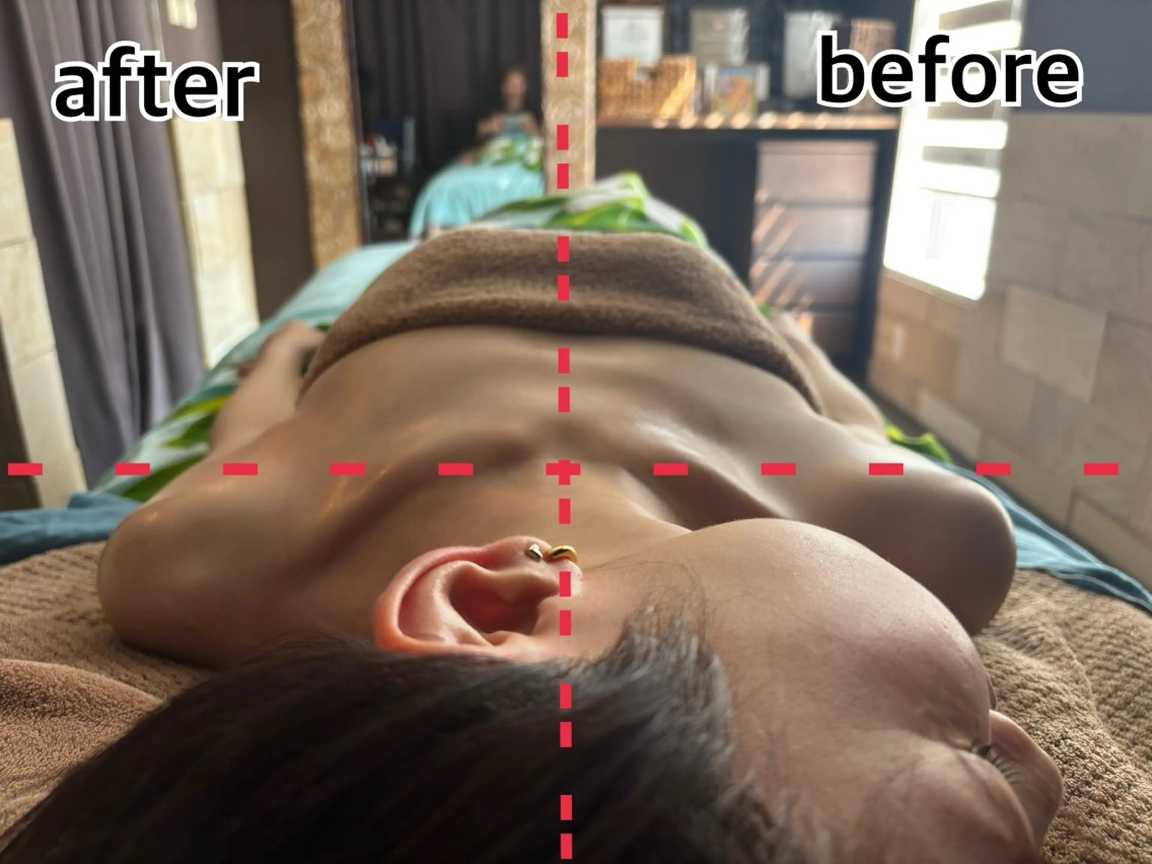 肌質改善🕊️ hirokoのエステ・リラクイメージ