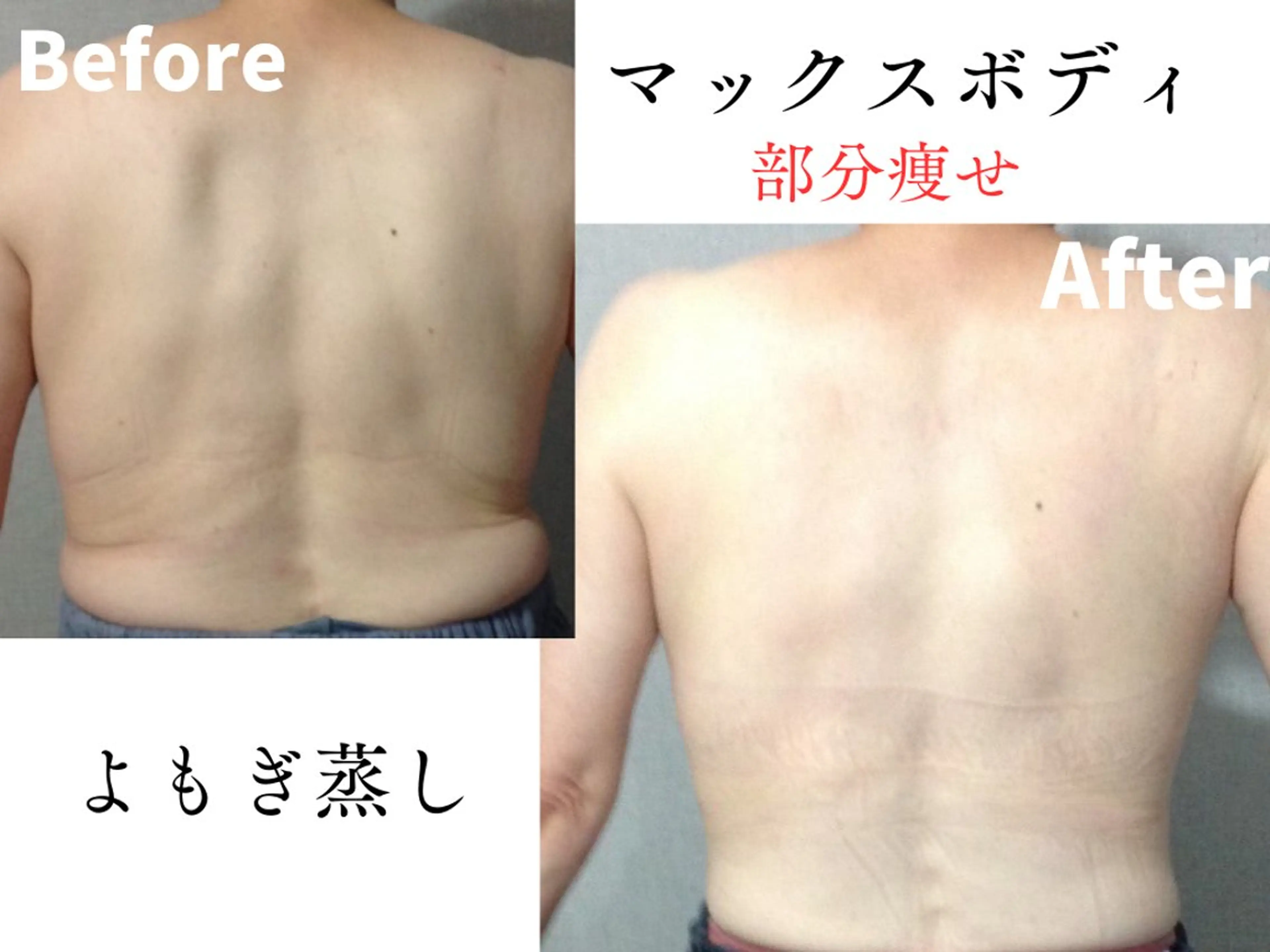 【痩身】よもぎ蒸し×選べる部位痩せセットの写真