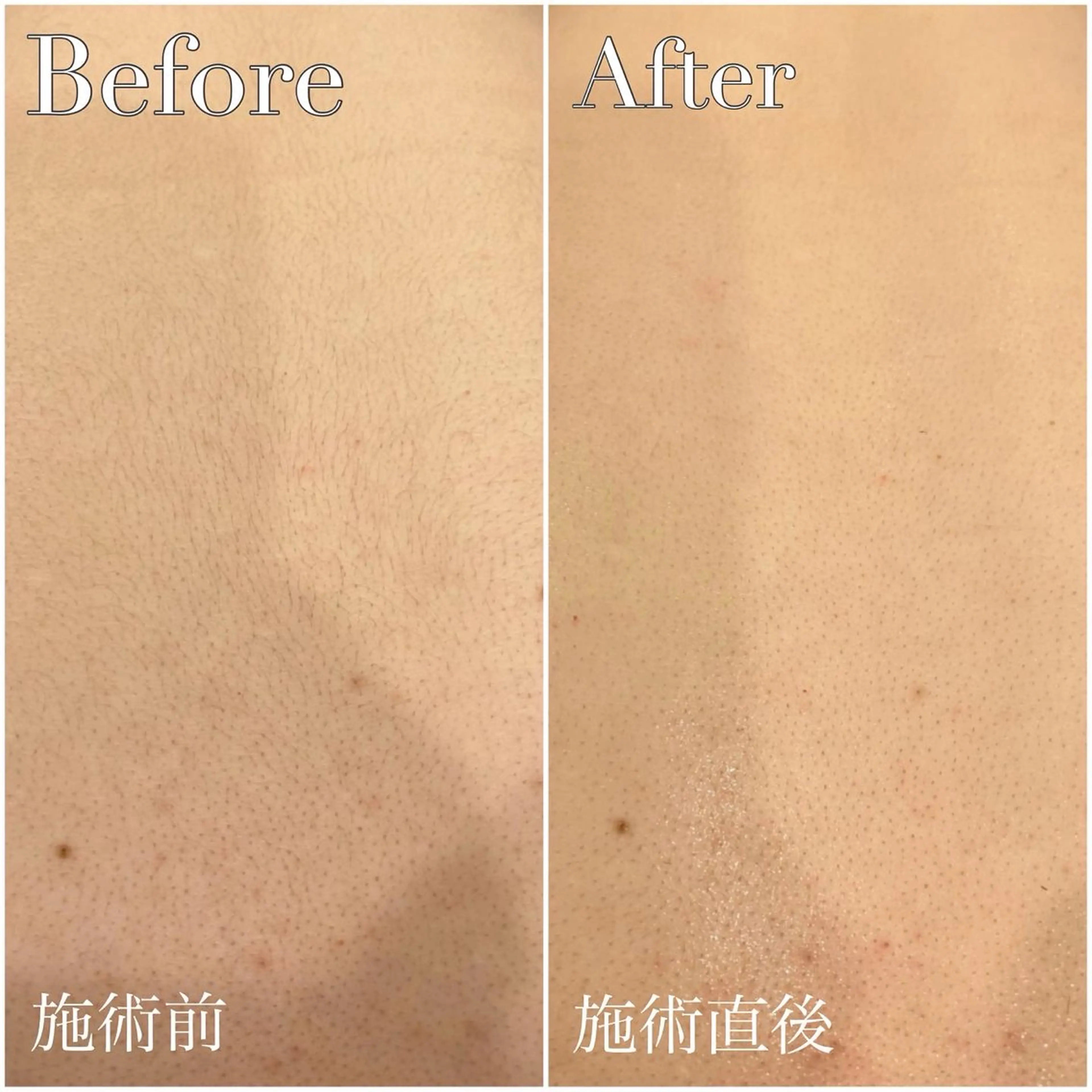 脱毛 プライベートサロン リプレイスのエステ・リラクイメージ