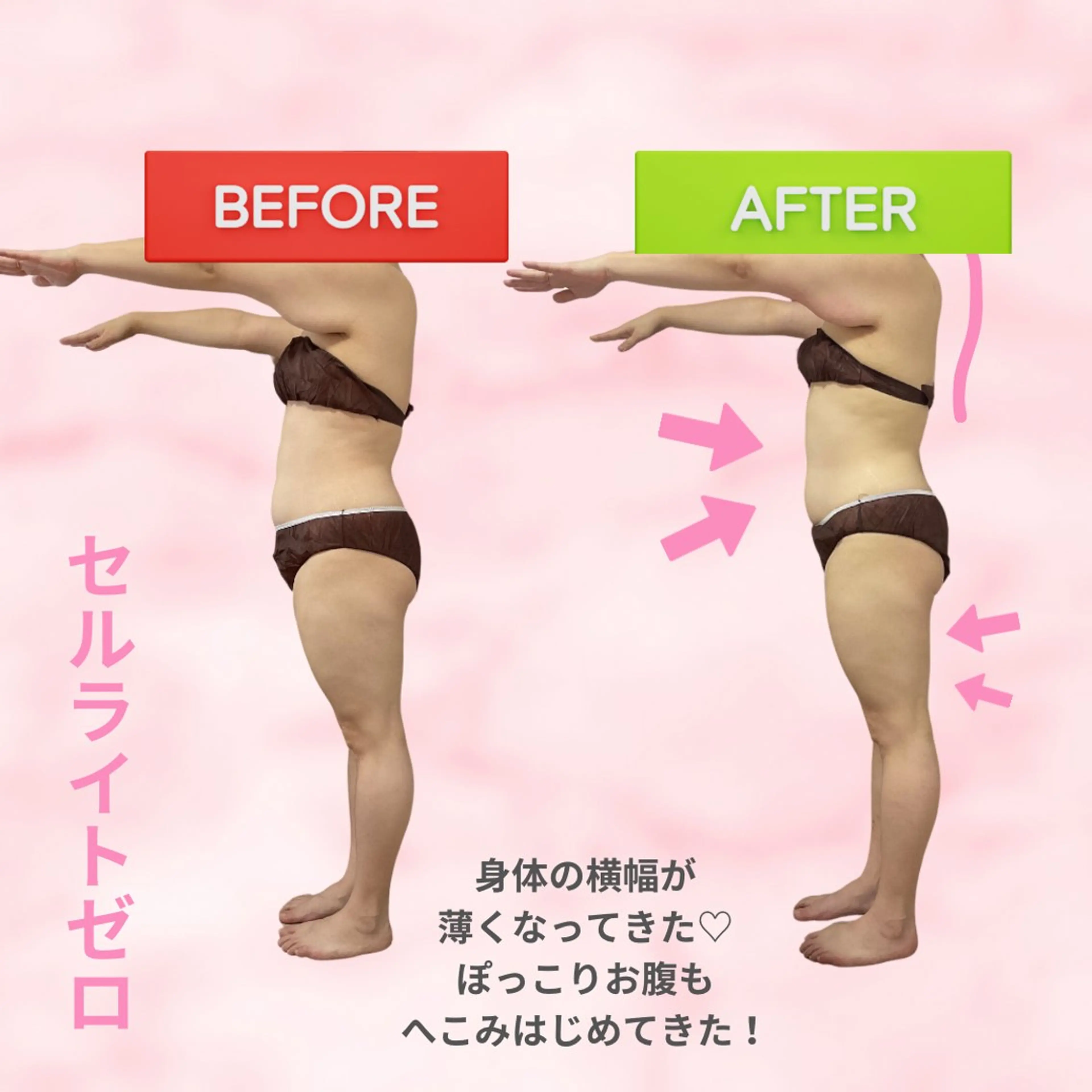 エステ 肌質改善サロン ココマヒナのエステ・リラクイメージ