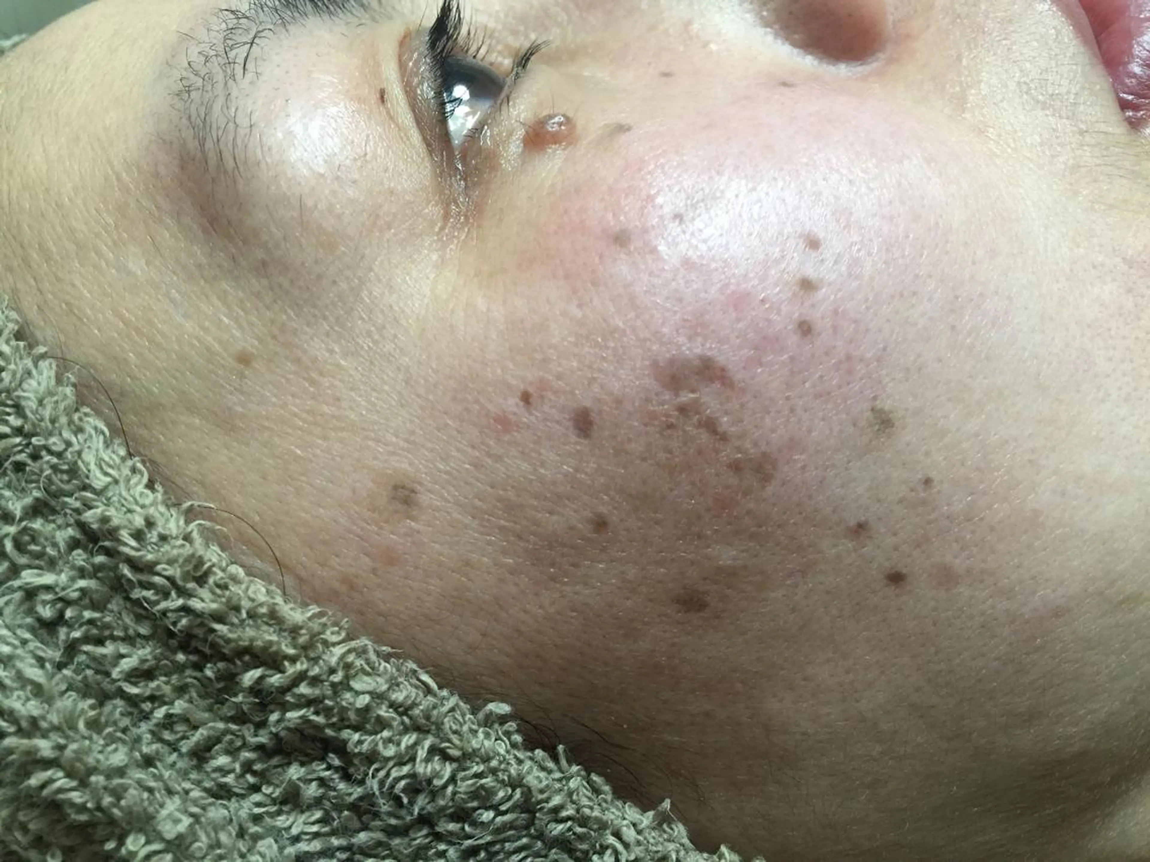 脱毛｜ピーリング ROOM.Sのエステ・リラクイメージ