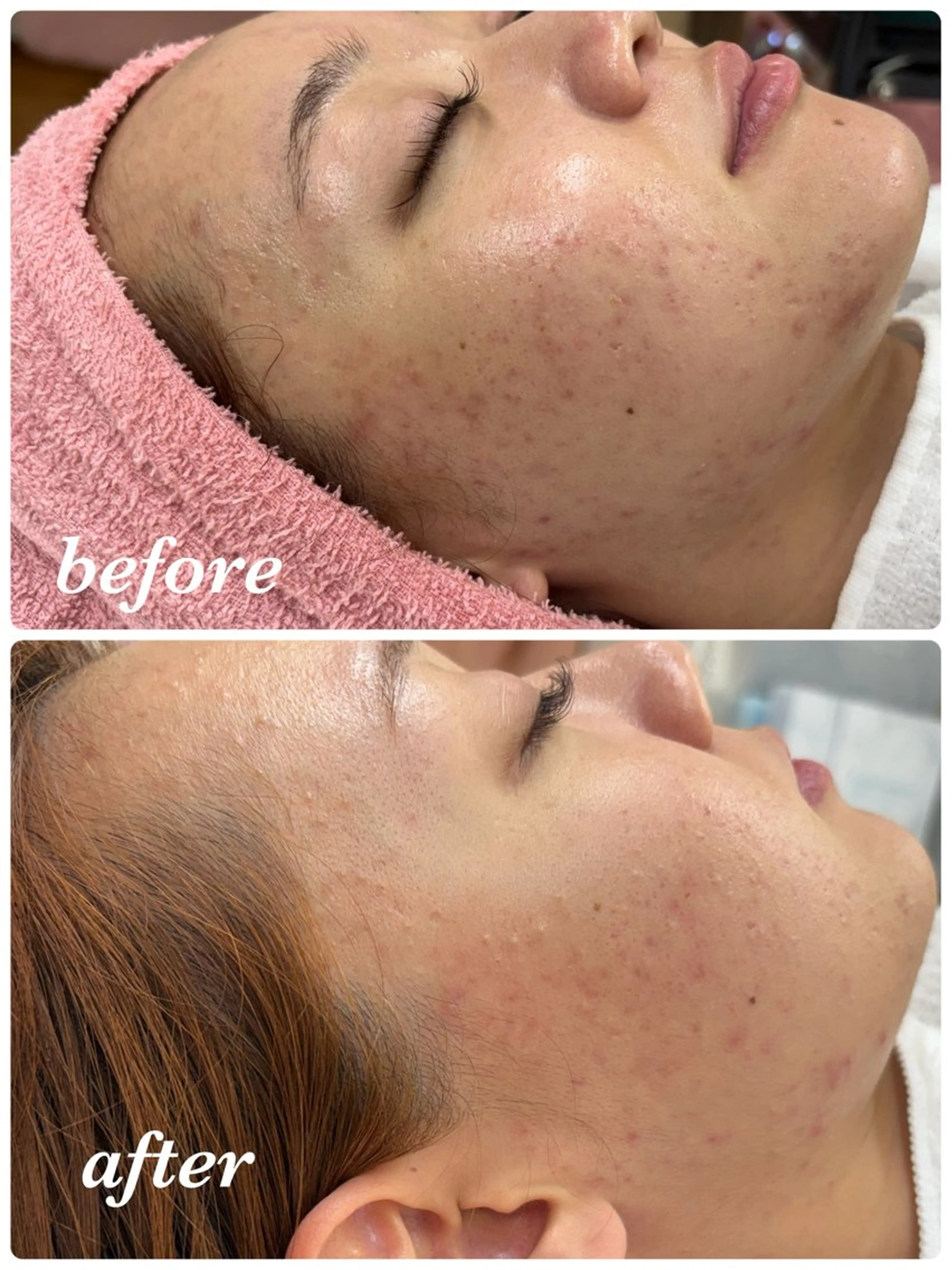 エステ フェイシャルサロン クリスタのエステ・リラクイメージ