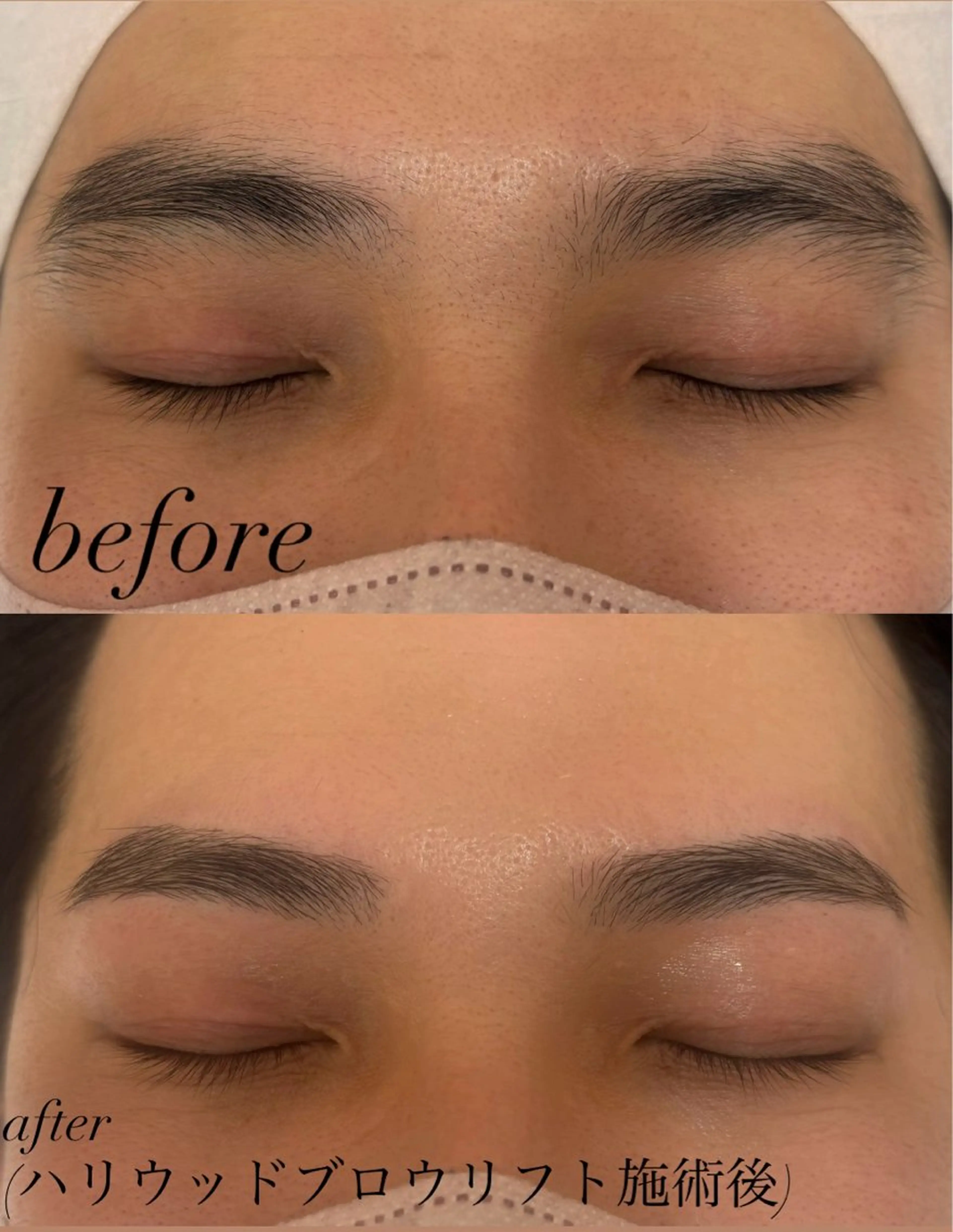 メンズ アイブロウ ハリウッドブロウリフト トレンド眉🌈✨️ misuzu.nの眉毛・アイブロウイメージ