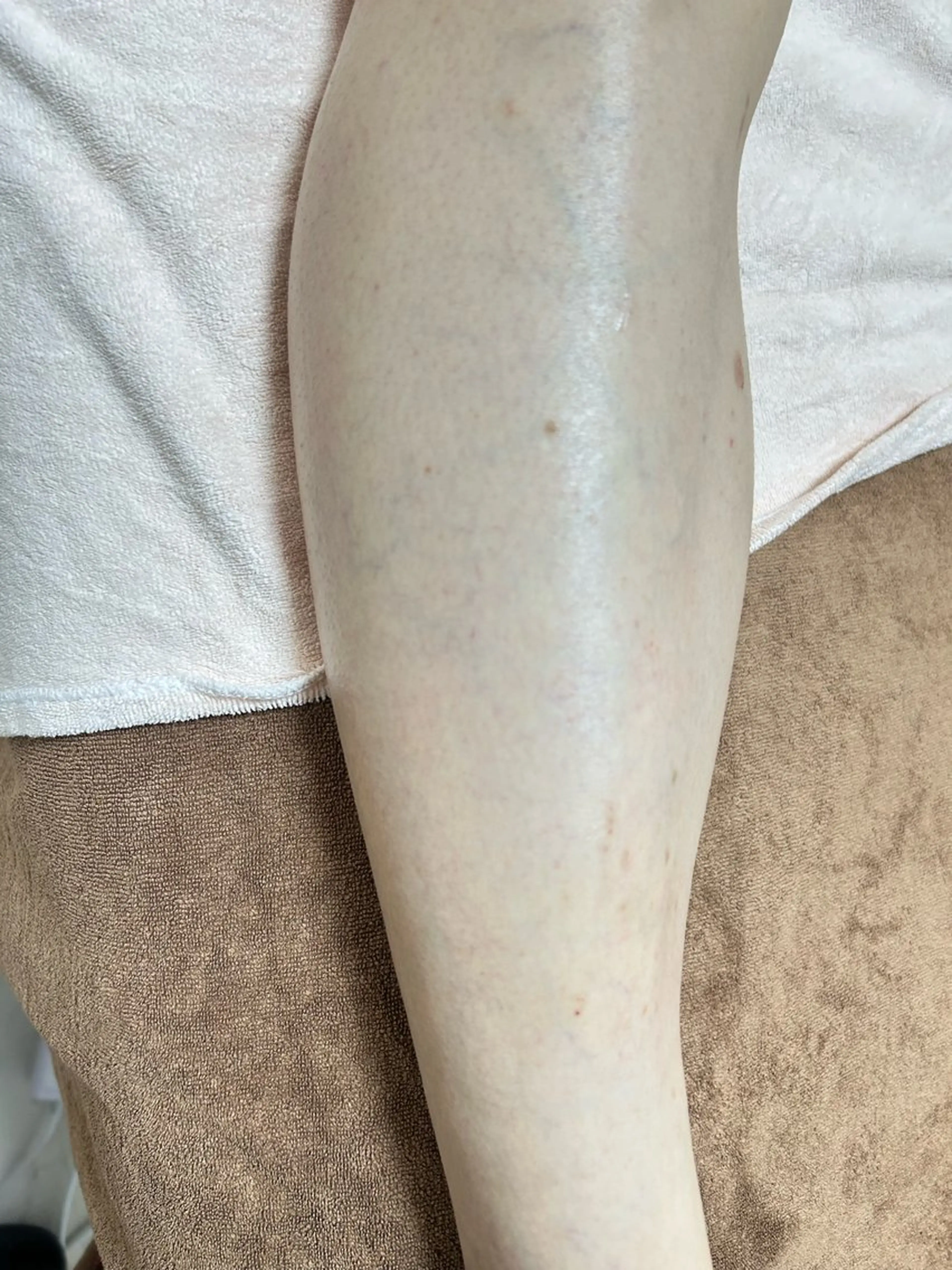 脱毛 都度払い制脱毛サロンBe Charm所属・Be Charm 山﨑のエステ・リラクイメージ