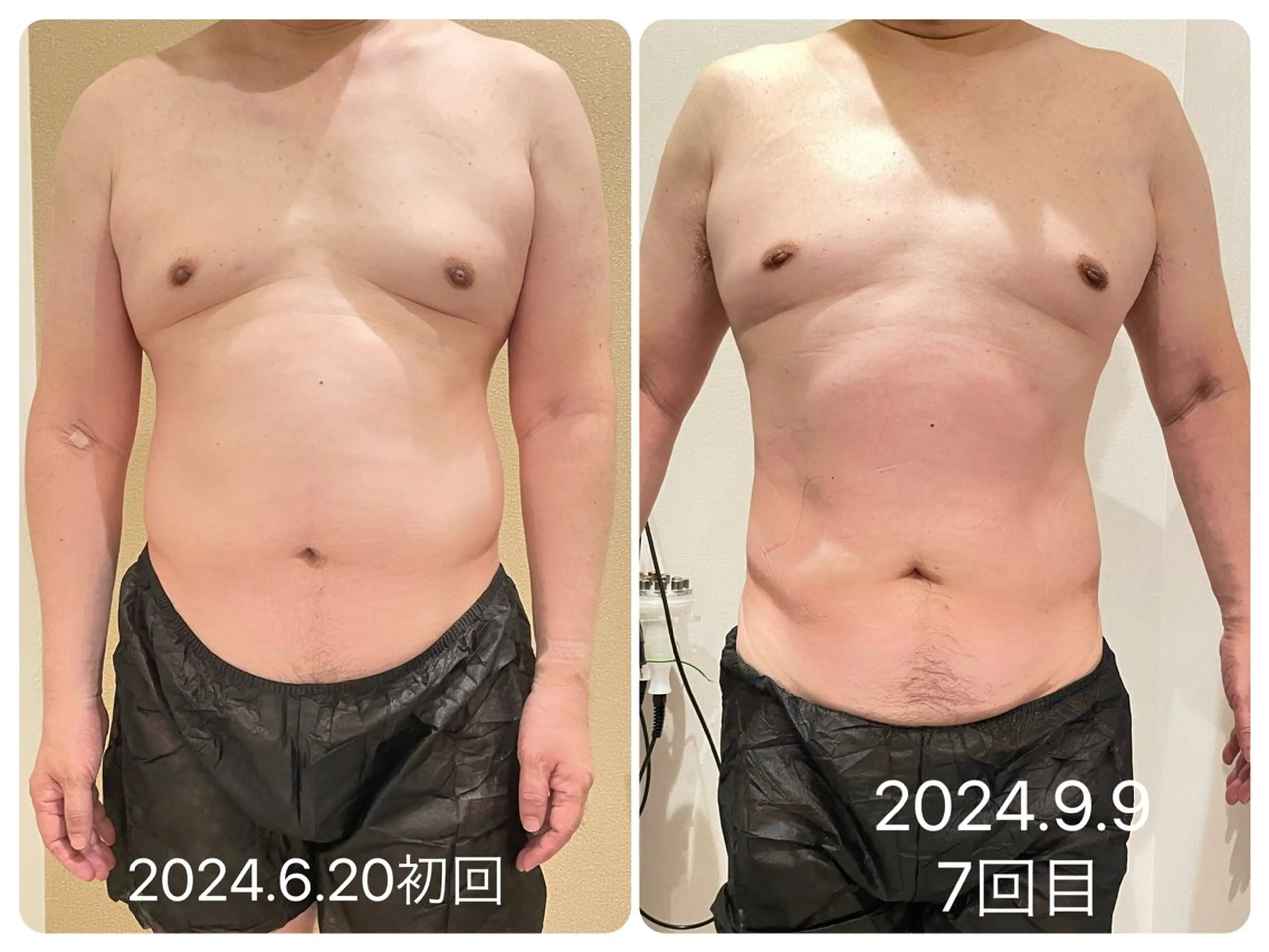 エステ リラク 小顔＆まつ毛サロン AKANE❤️のエステ・リラクイメージ