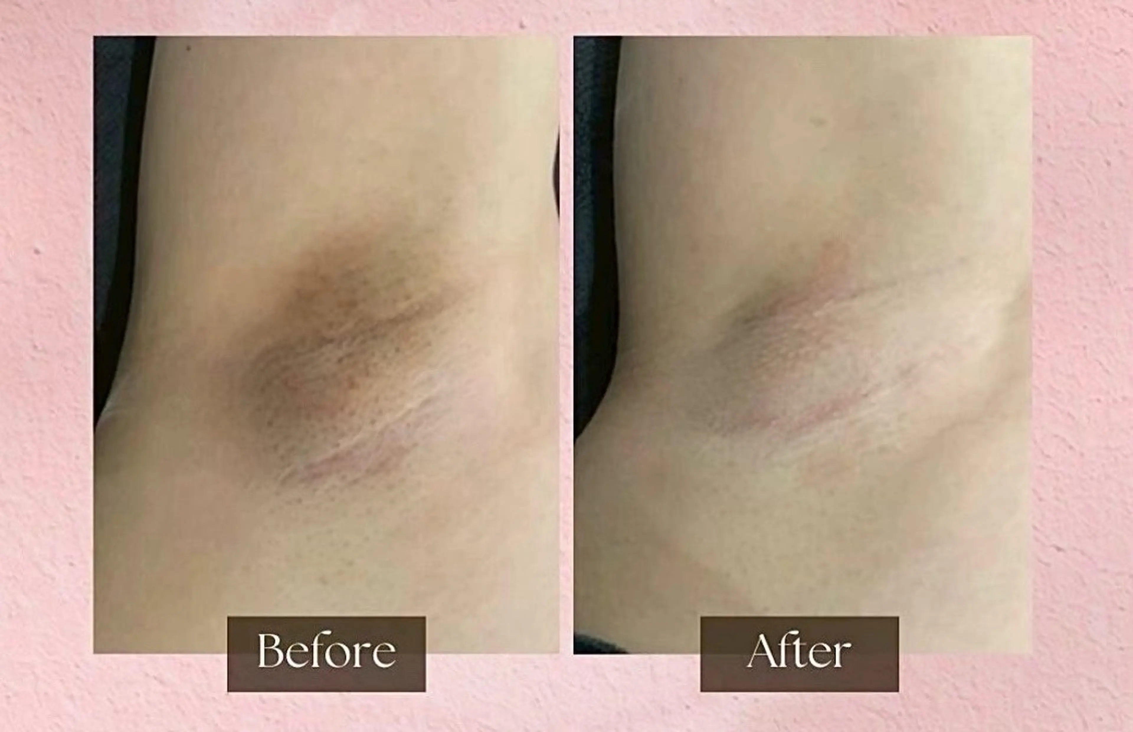 Salon de sharmant所属・岡 本のエステ・リラクイメージ