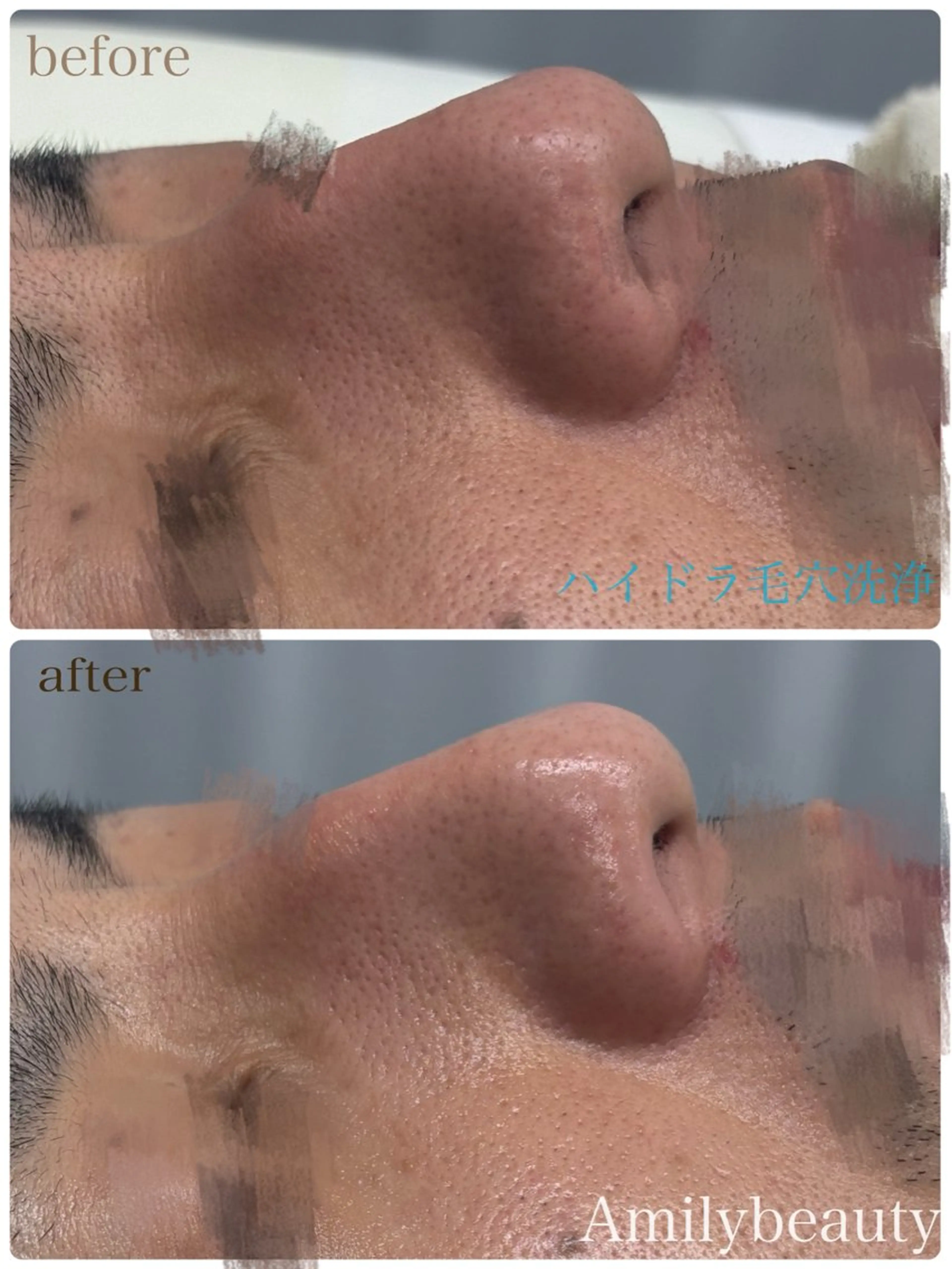 Amilybeauty所属・Amily beauty 毛利のその他イメージ