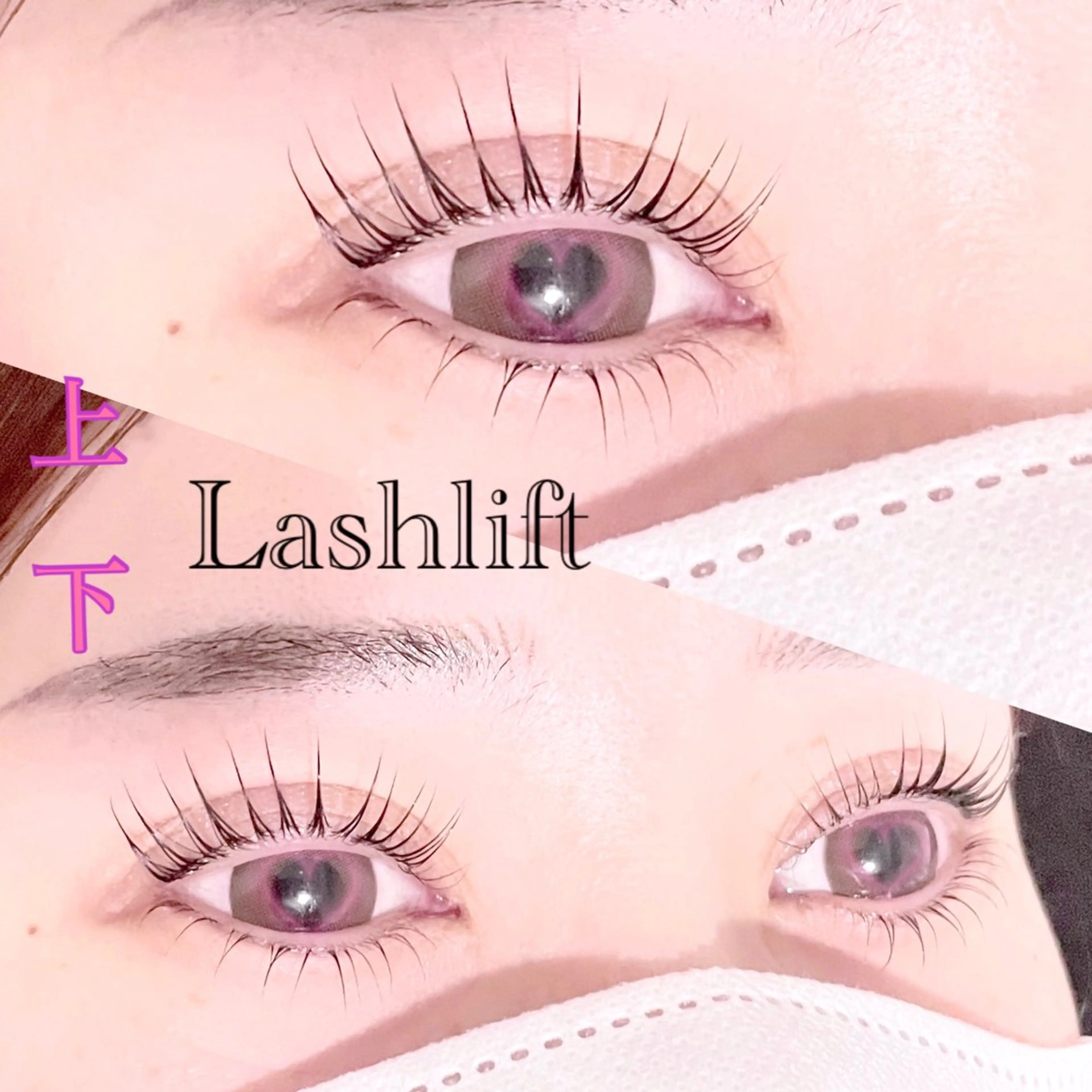 顔面偏差値UP💎ﾗｯｼｭﾘﾌﾄ【上下】の写真