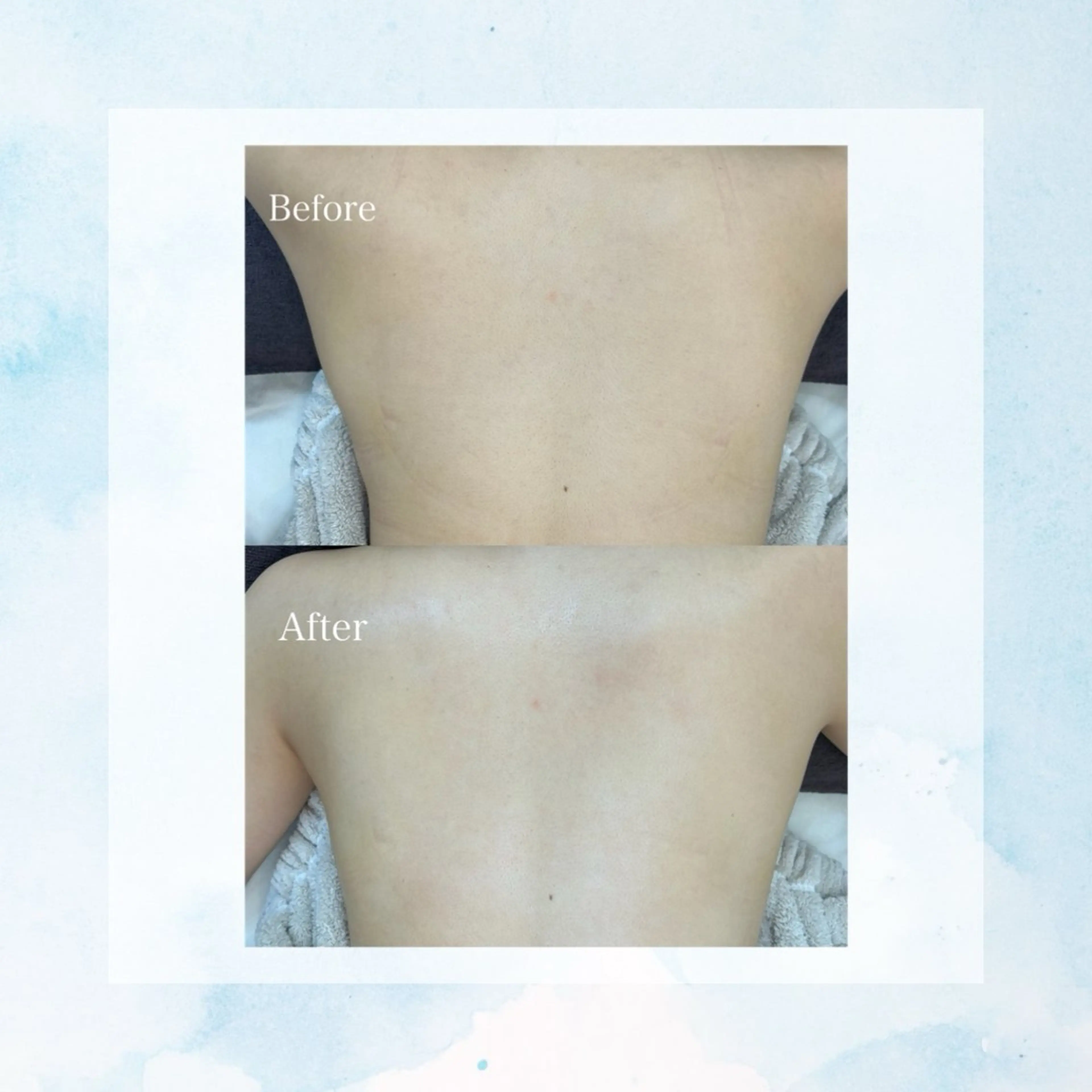 Belle  beauty  salon所属・Bellebeau tysalonのエステ・リラクイメージ