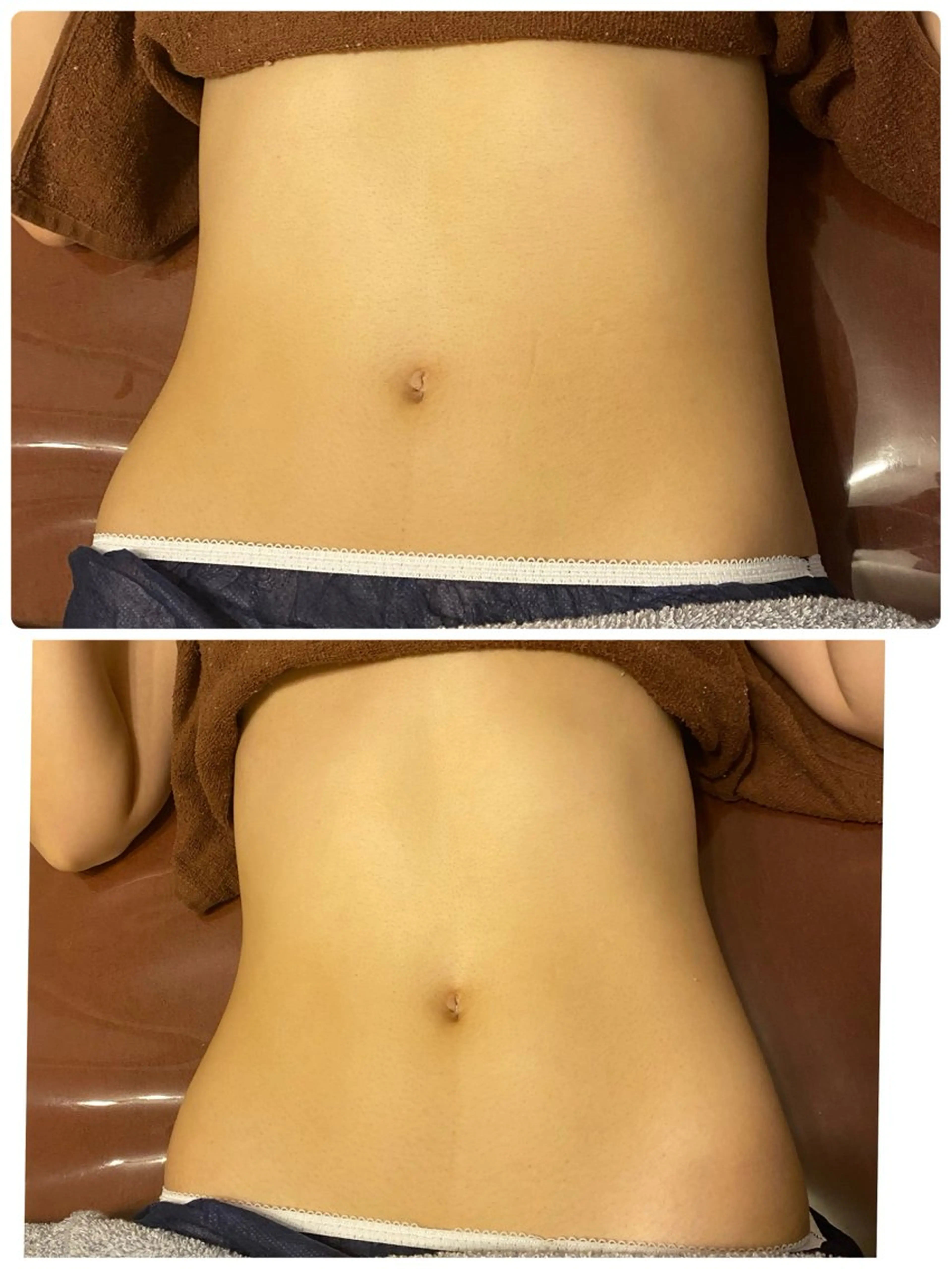 【初回】セルライトに！上半身or下半身1時間(キャビテーション付き)の写真