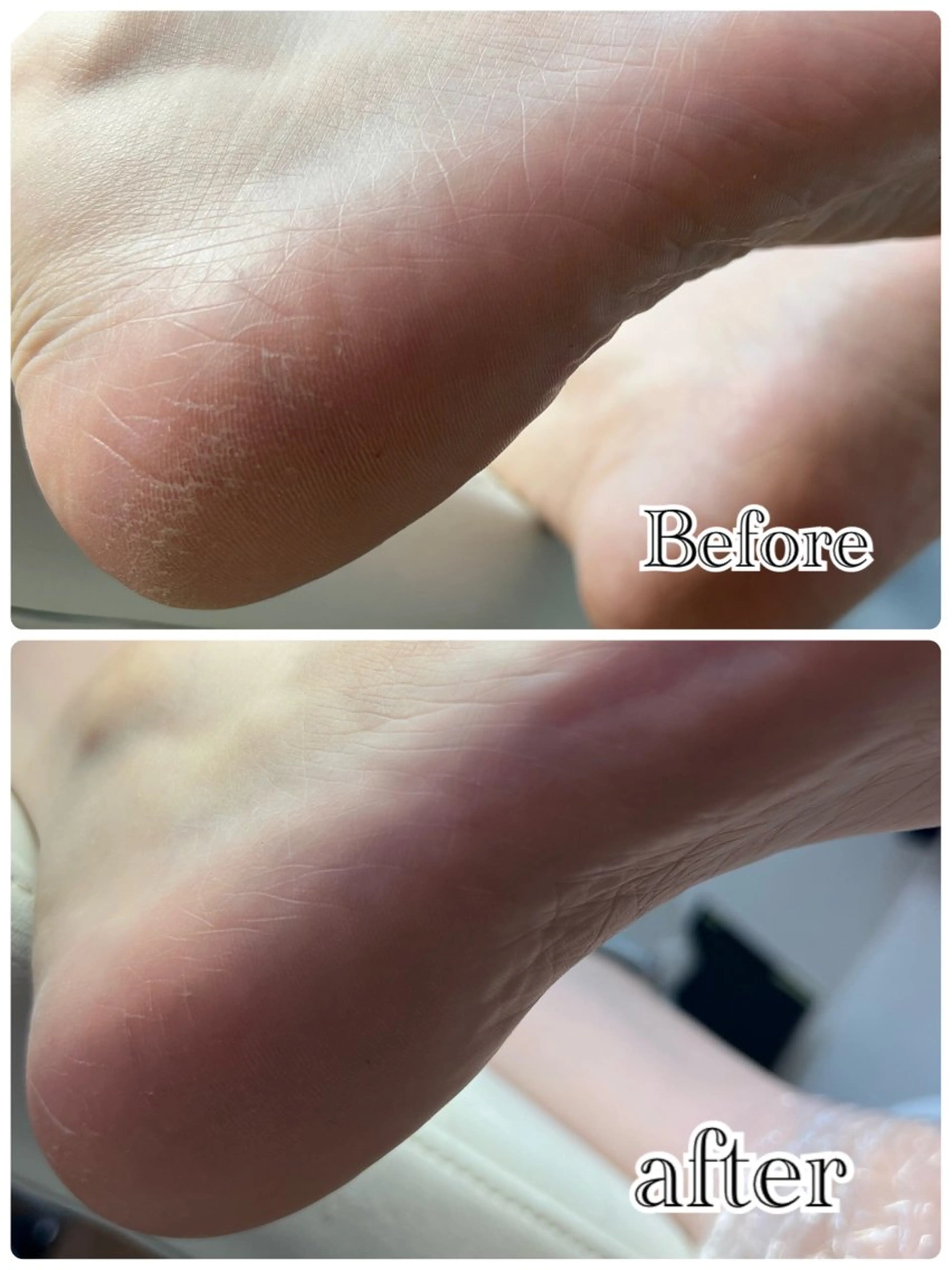 ❤︎MN❤︎ モンのエステ・リラクイメージ