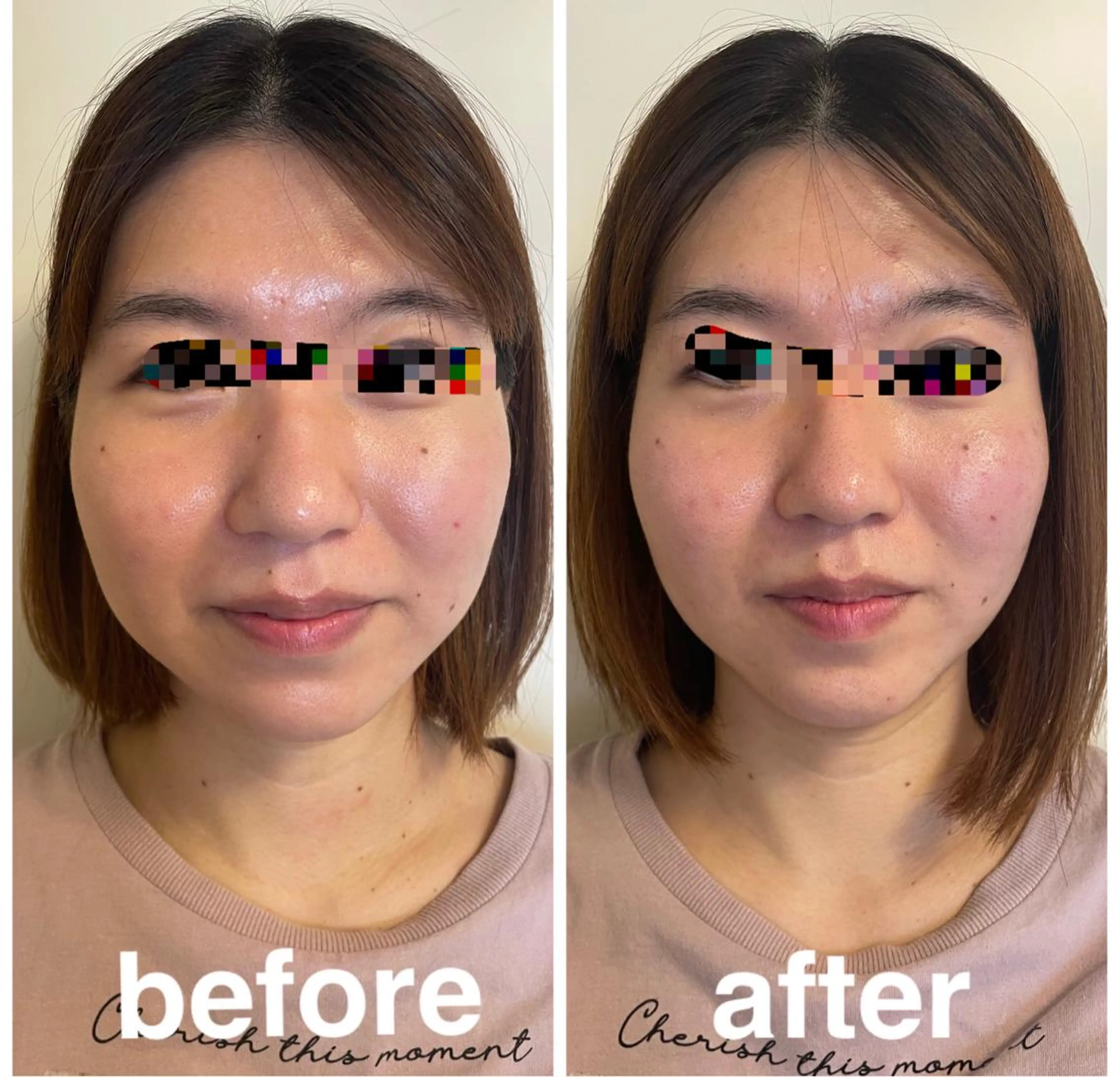 美容鍼灸サロン mahoroba院長のエステ・リラクイメージ