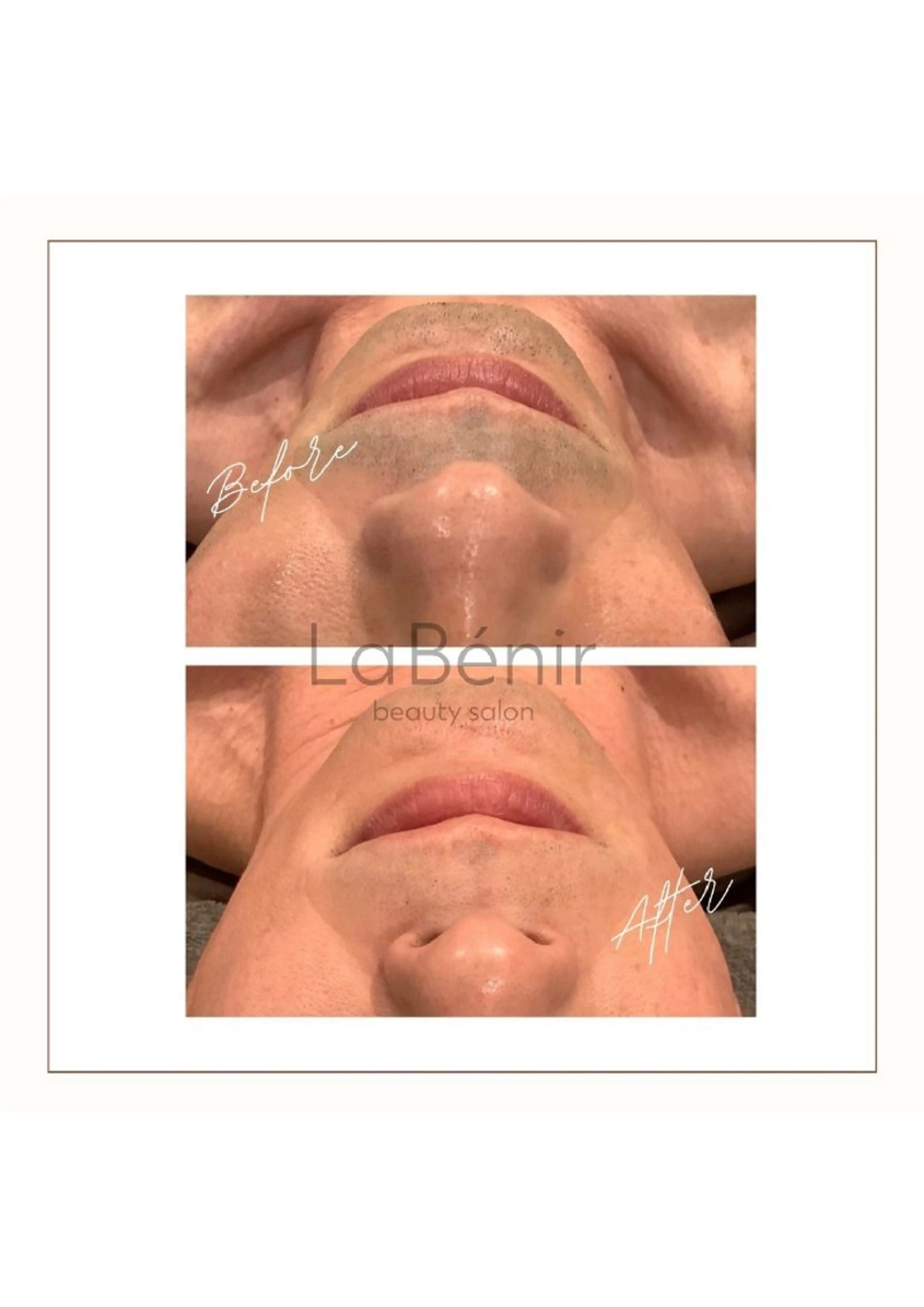 メンズ エステ 脱毛/美肌【皮膚科看 護師経営】ラベニールのエステ・リラクイメージ