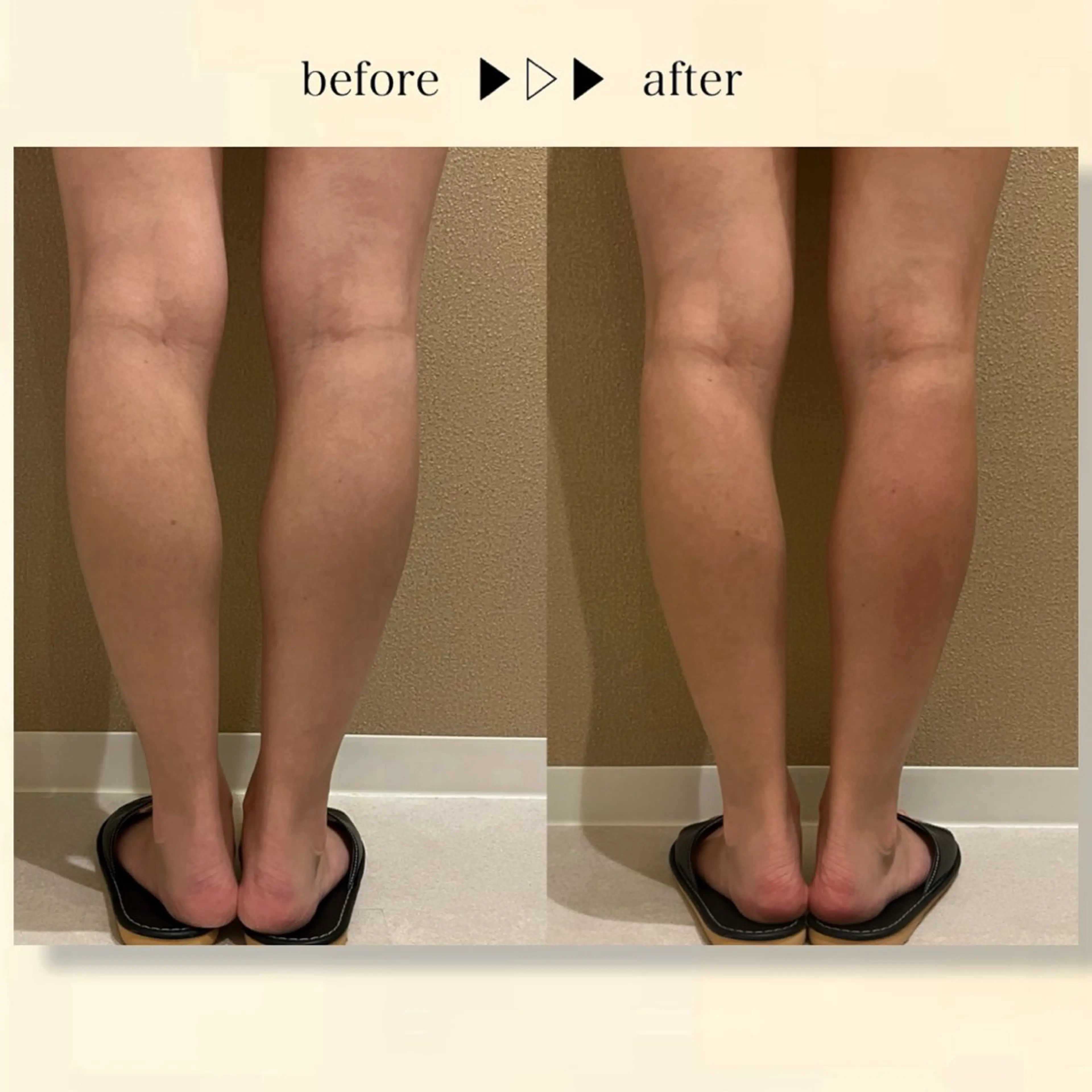 ☆痩身/小顔☆ コルギのエステ・リラクイメージ