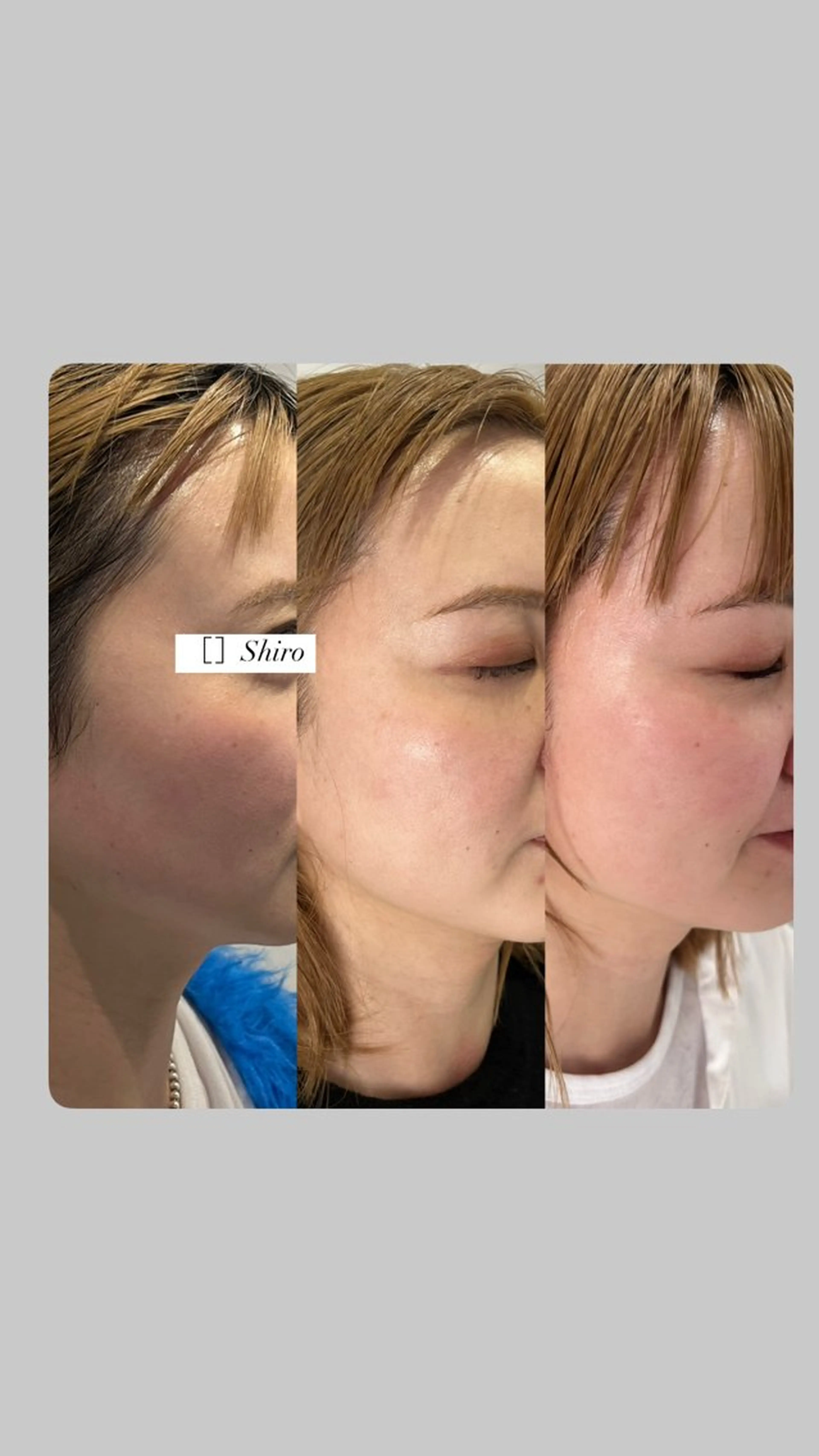 ［　］Shiro Meiのエステ・リラクイメージ