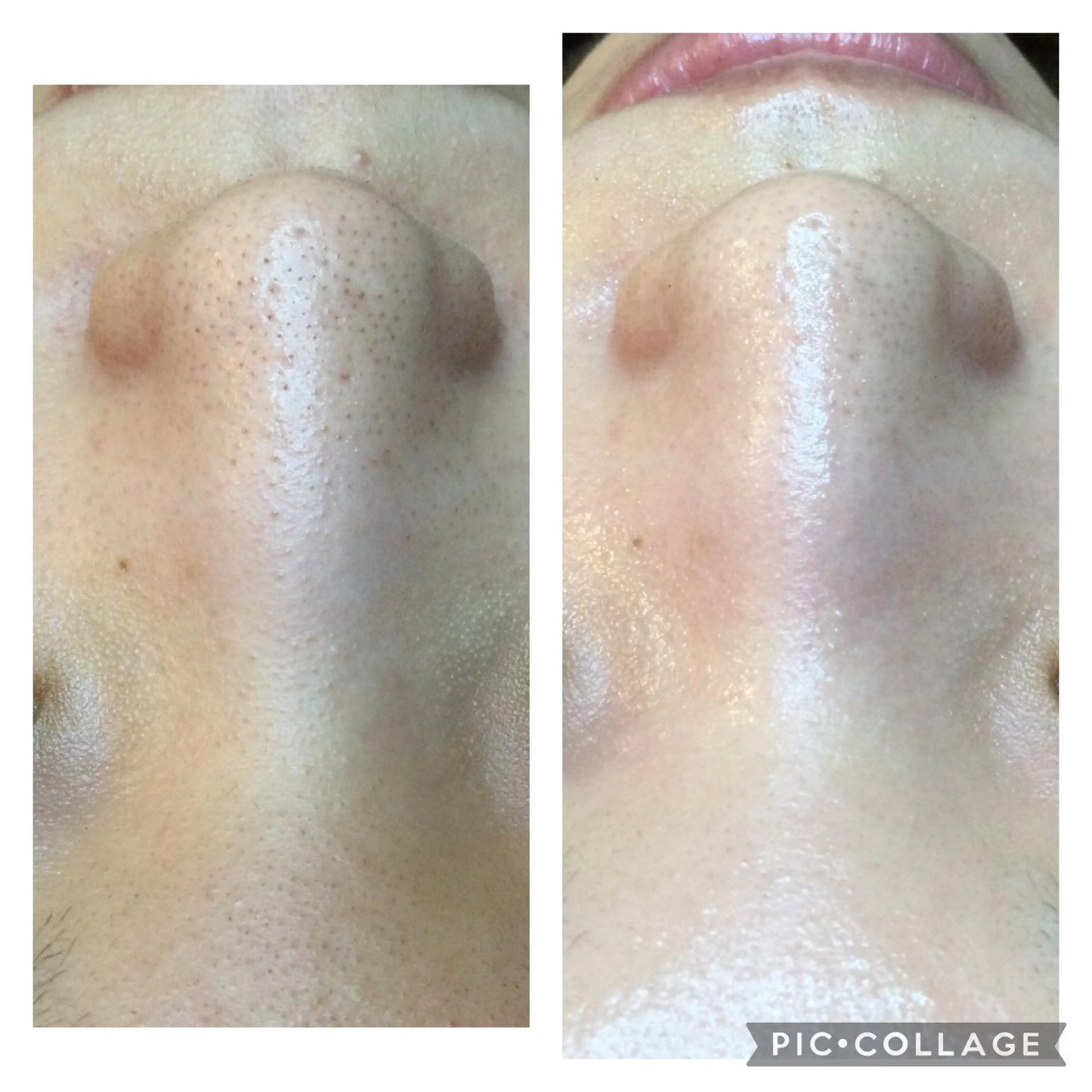 ニキビ/肌質改善専門 Snow skinのエステ・リラクイメージ