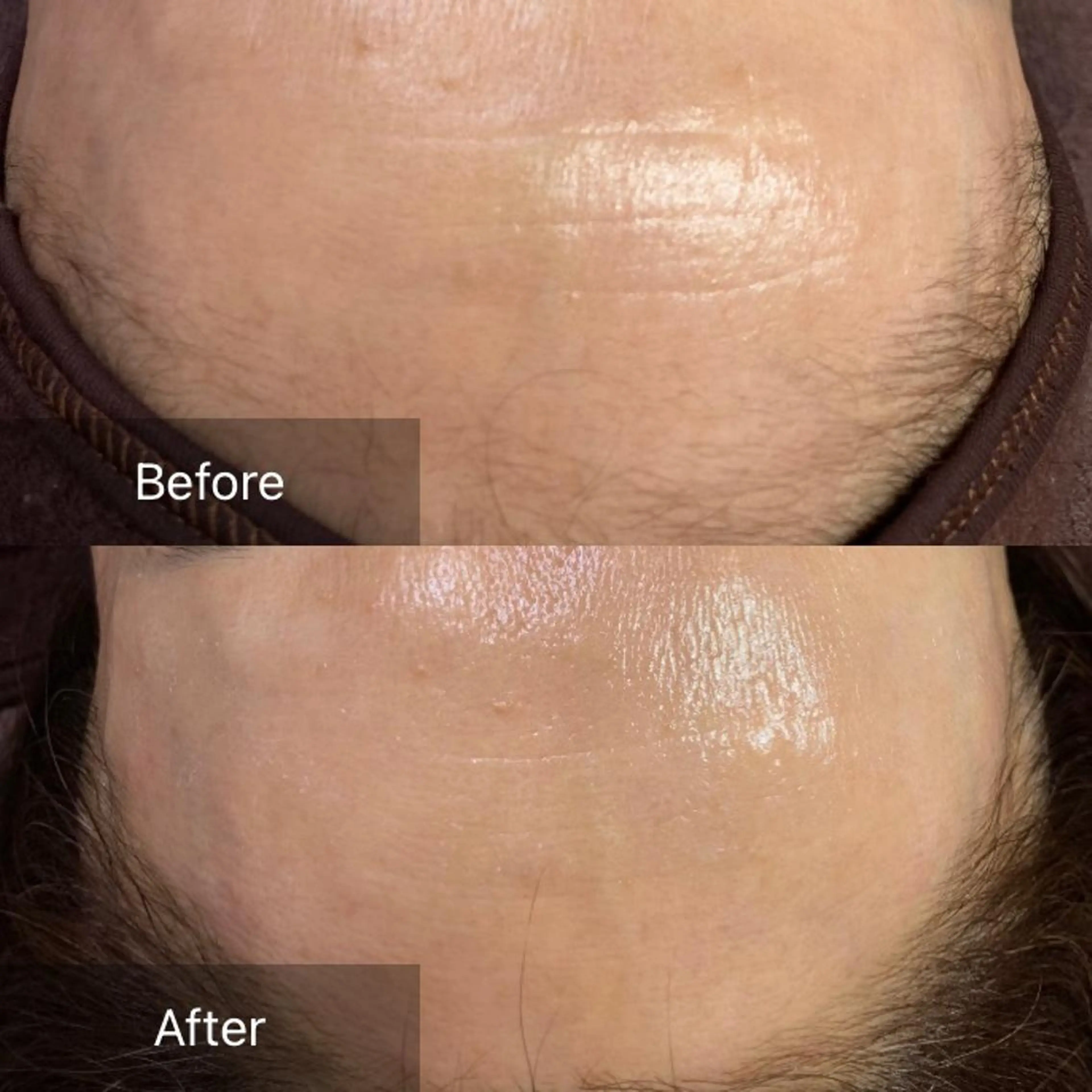 脱毛 産毛専門店 Bittoのエステ・リラクイメージ