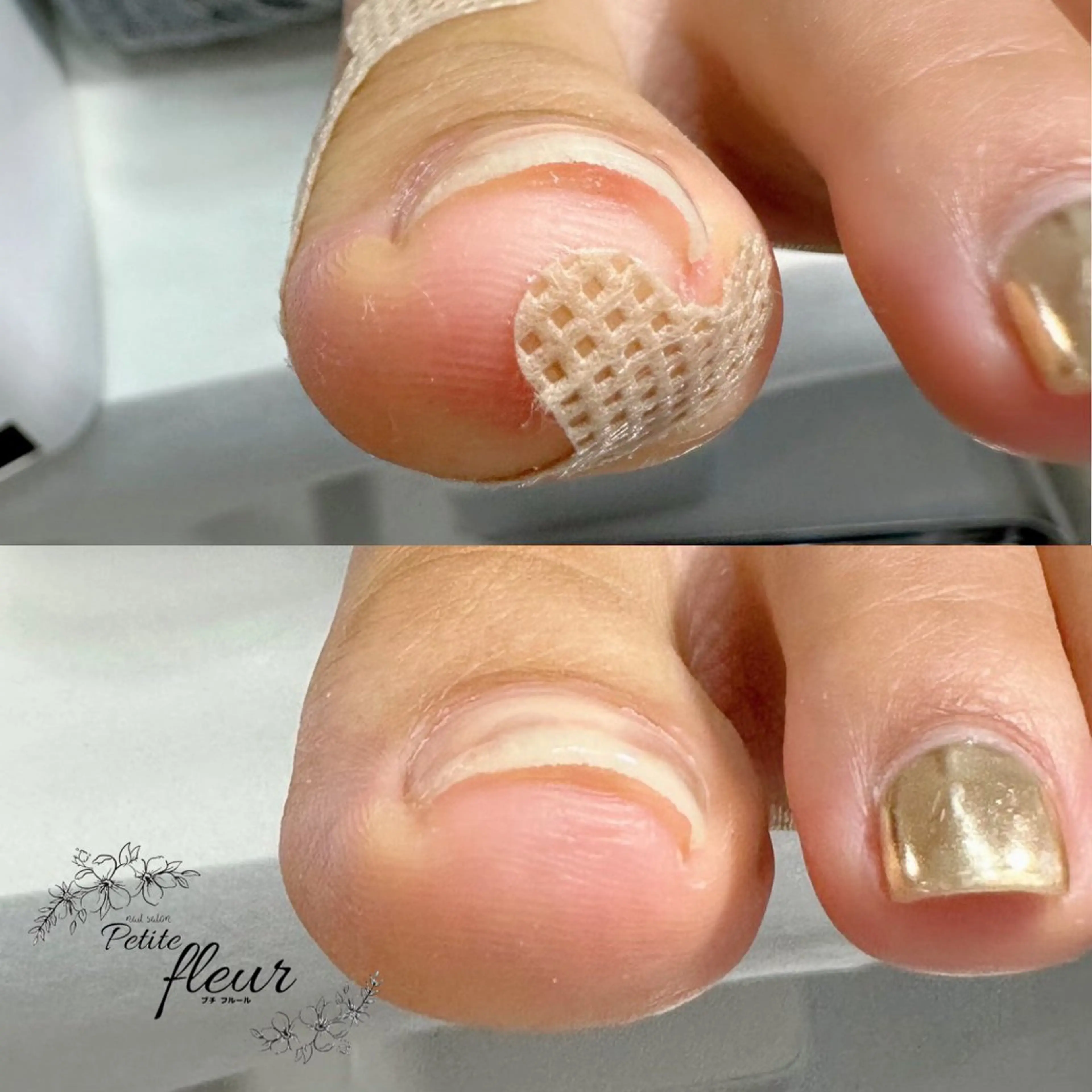 ネイル フットネイル ❁⃘*。Petite fleur❁⃘*りさのネイルデザイン