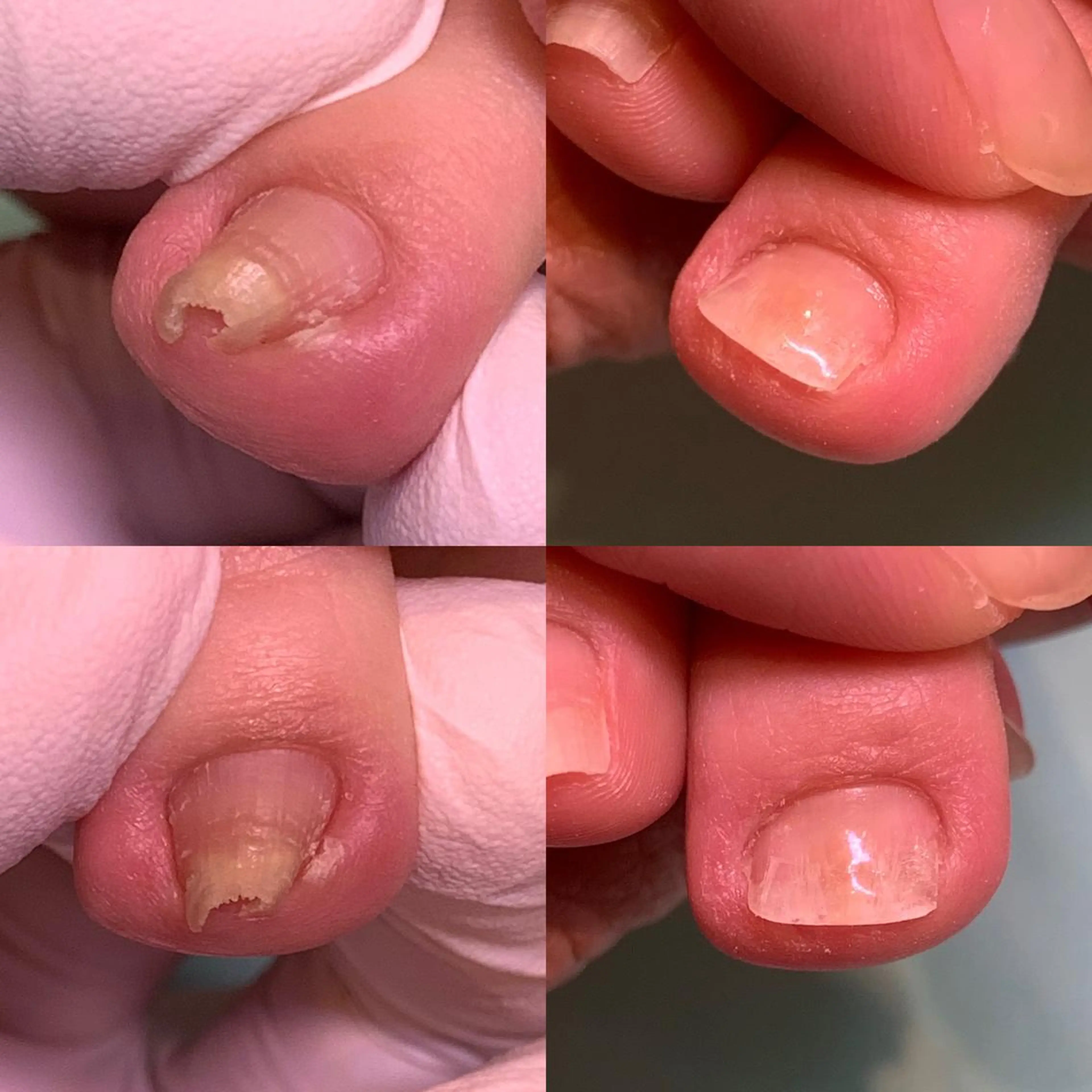 ネイル 東京巻き爪アカデミー所属・東京巻き爪 アカデミーのエステ・リラクイメージ