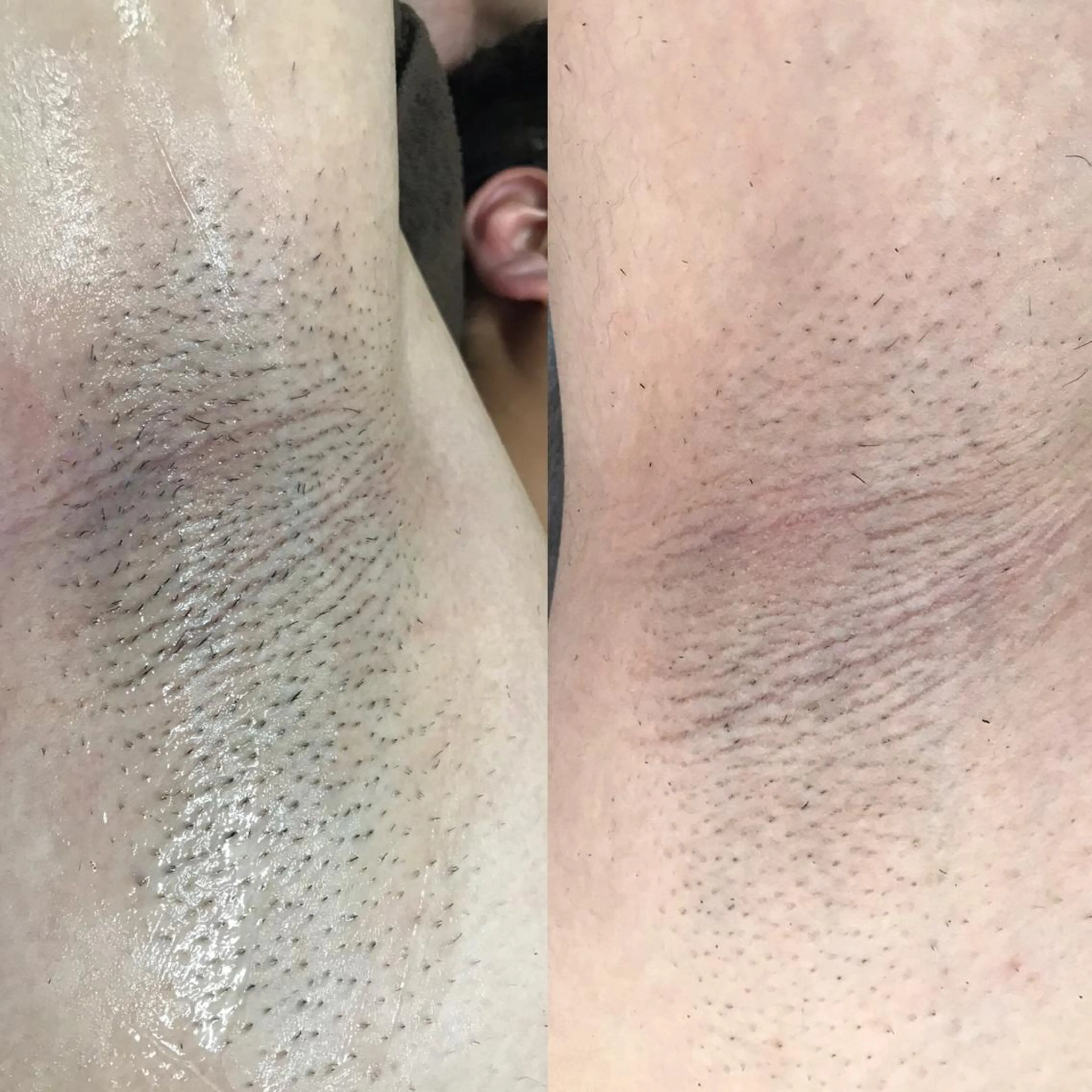 ネイル・脱毛サロンplage所属・脱毛サロン Plageプラージュのエステ・リラクイメージ