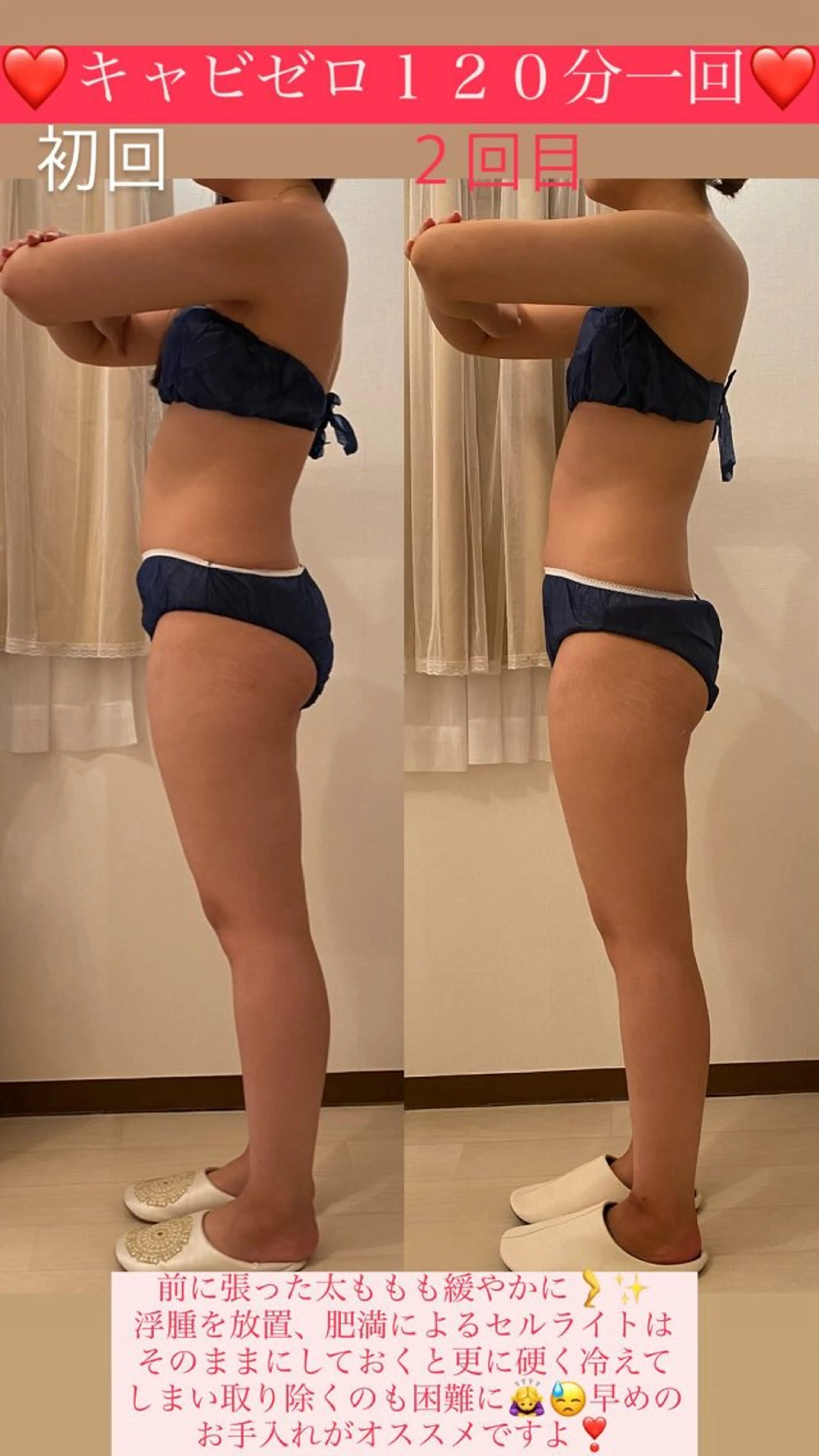 エステ Salon de Lino 御器所のエステ・リラクイメージ