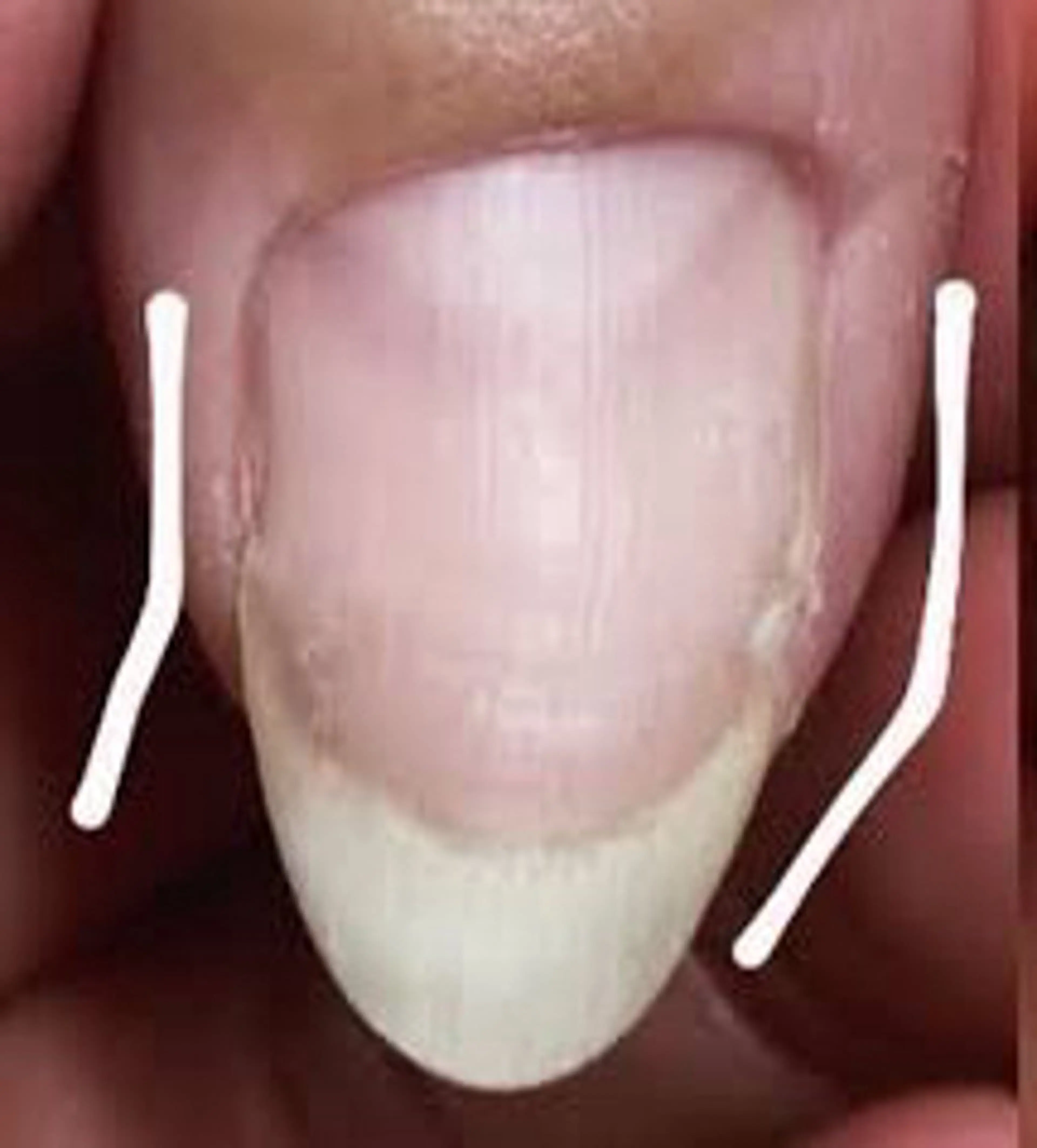 ネイル Y U K Iのネイルデザイン