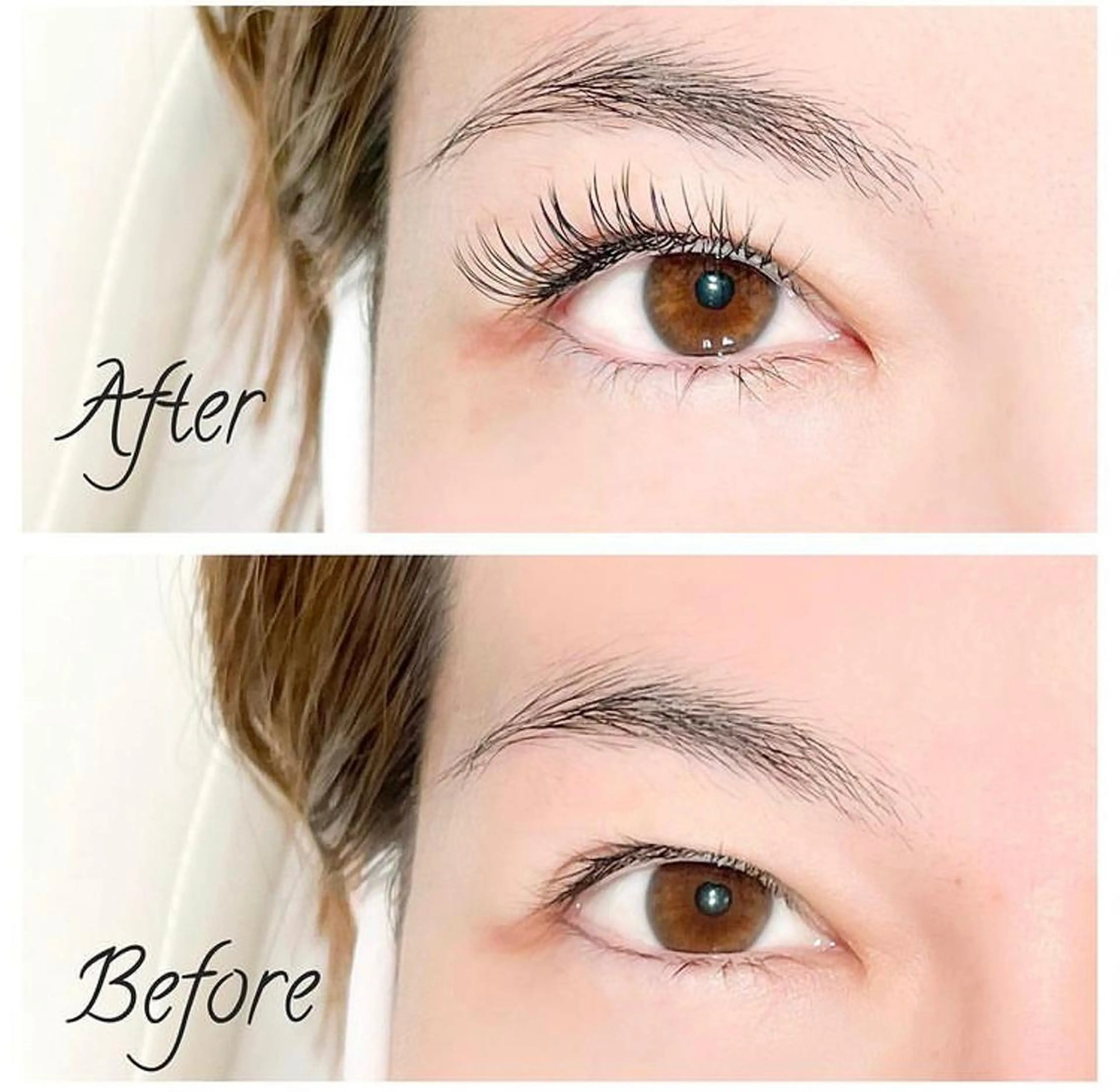 【期間限定❤️モニター価格】ぱっちりコース 120本　オフ込みの写真