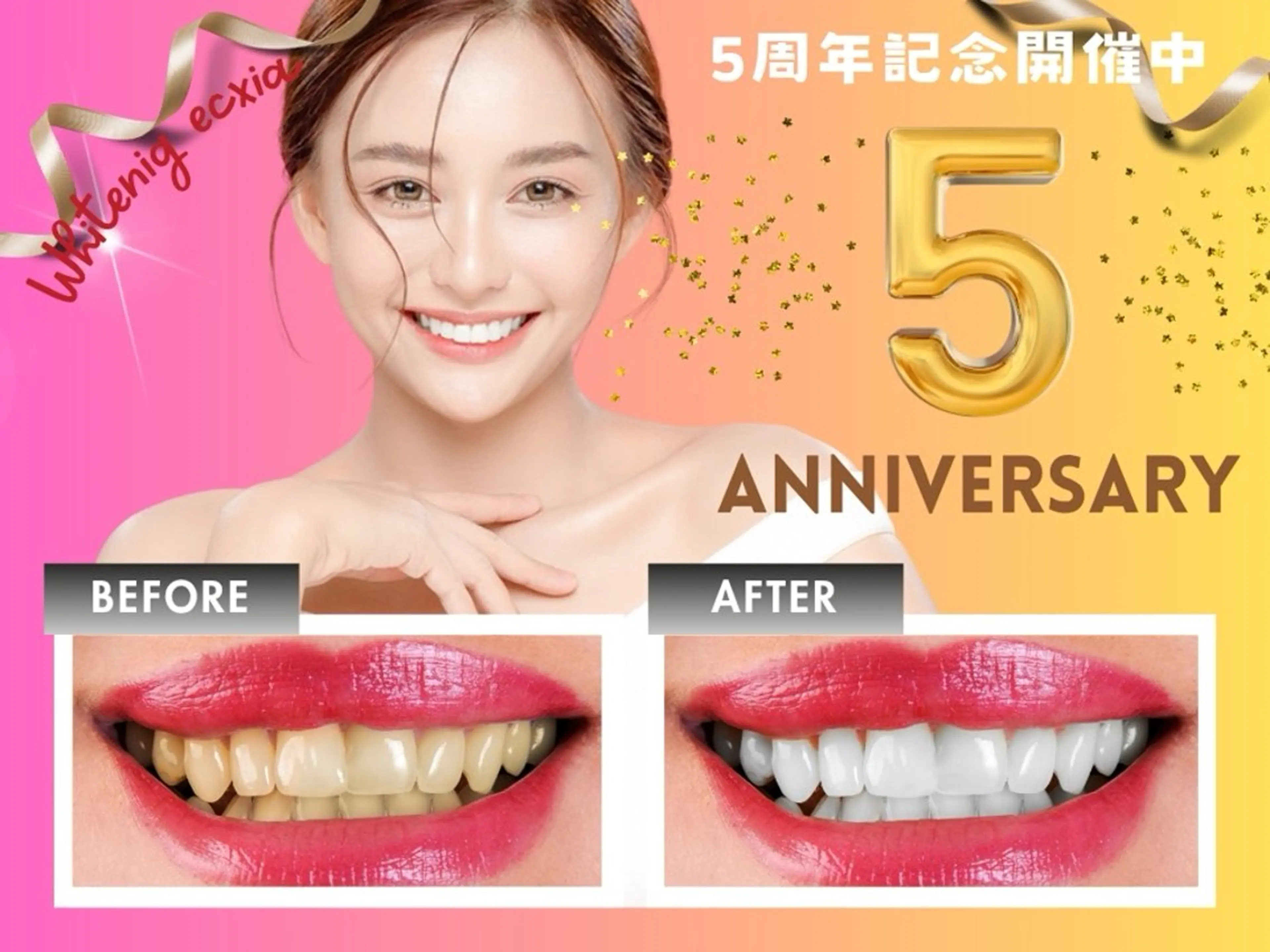 【黄色い歯を白くしたい！】コスパ最強！大人気の１ヶ月通い放題プラン♪【千葉駅/千葉中央駅】の写真