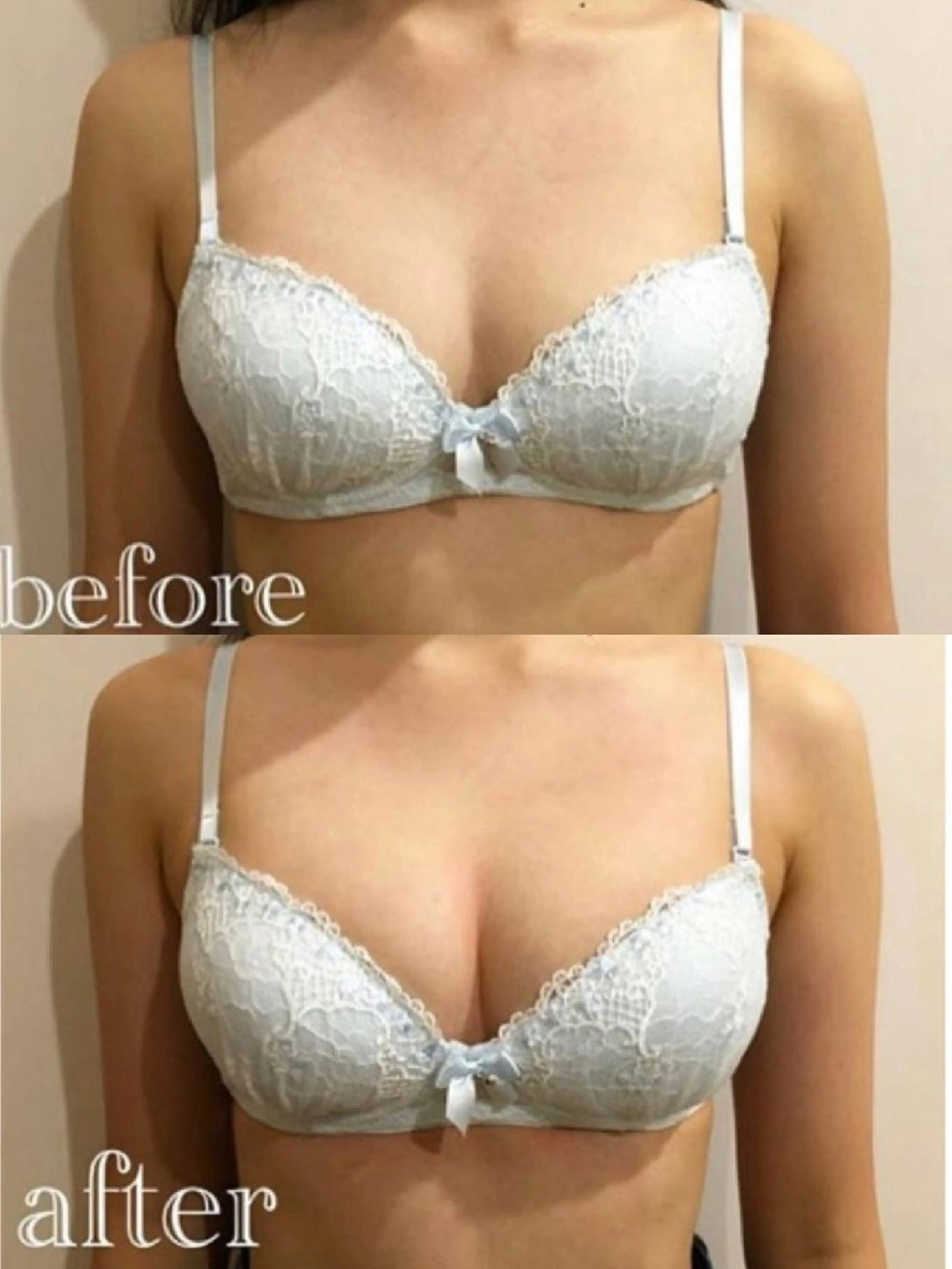 全身バストアップコース💗理想のバストを叶えます🪽の写真