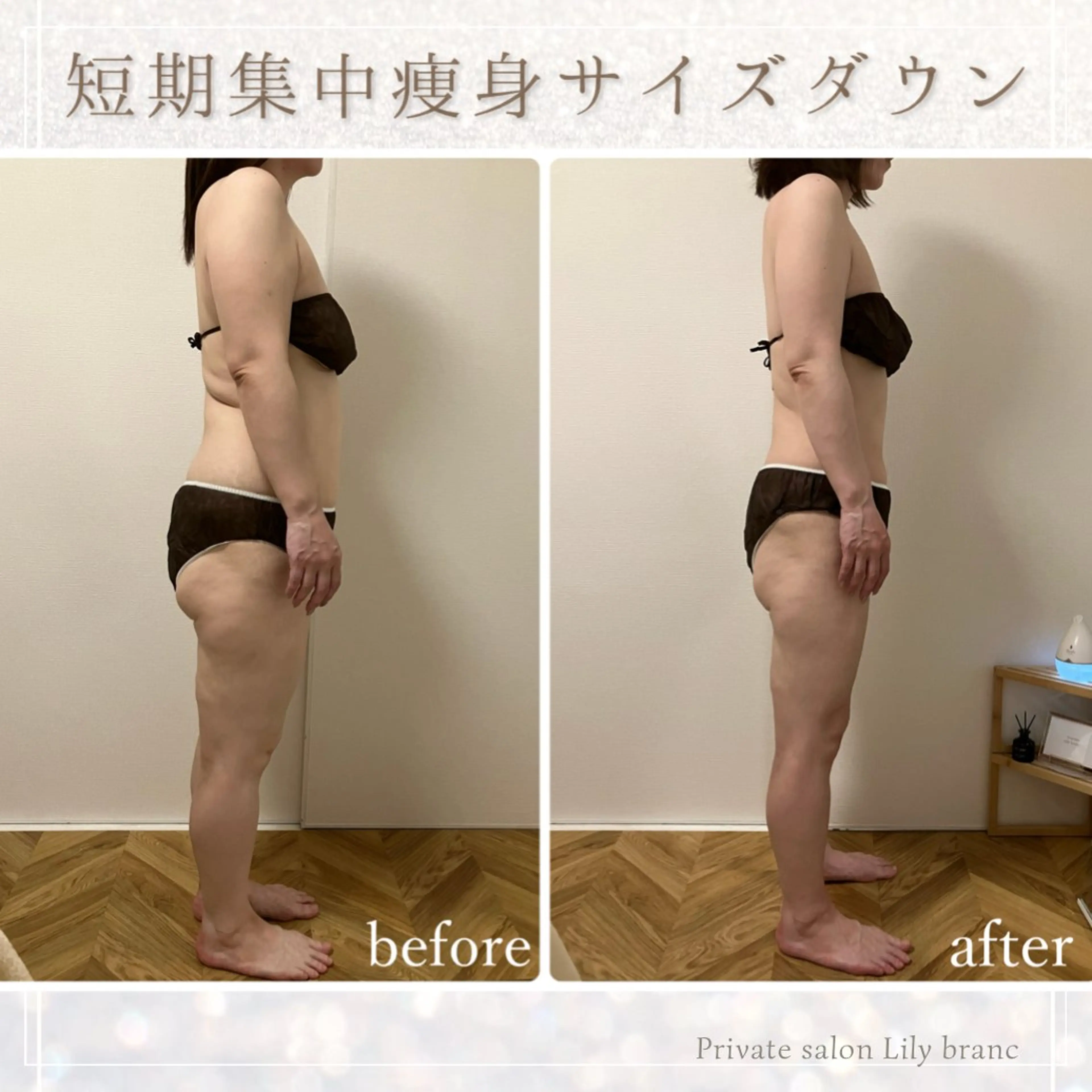 Lily branc 痩身/小顔/肌質改善のエステ・リラクイメージ