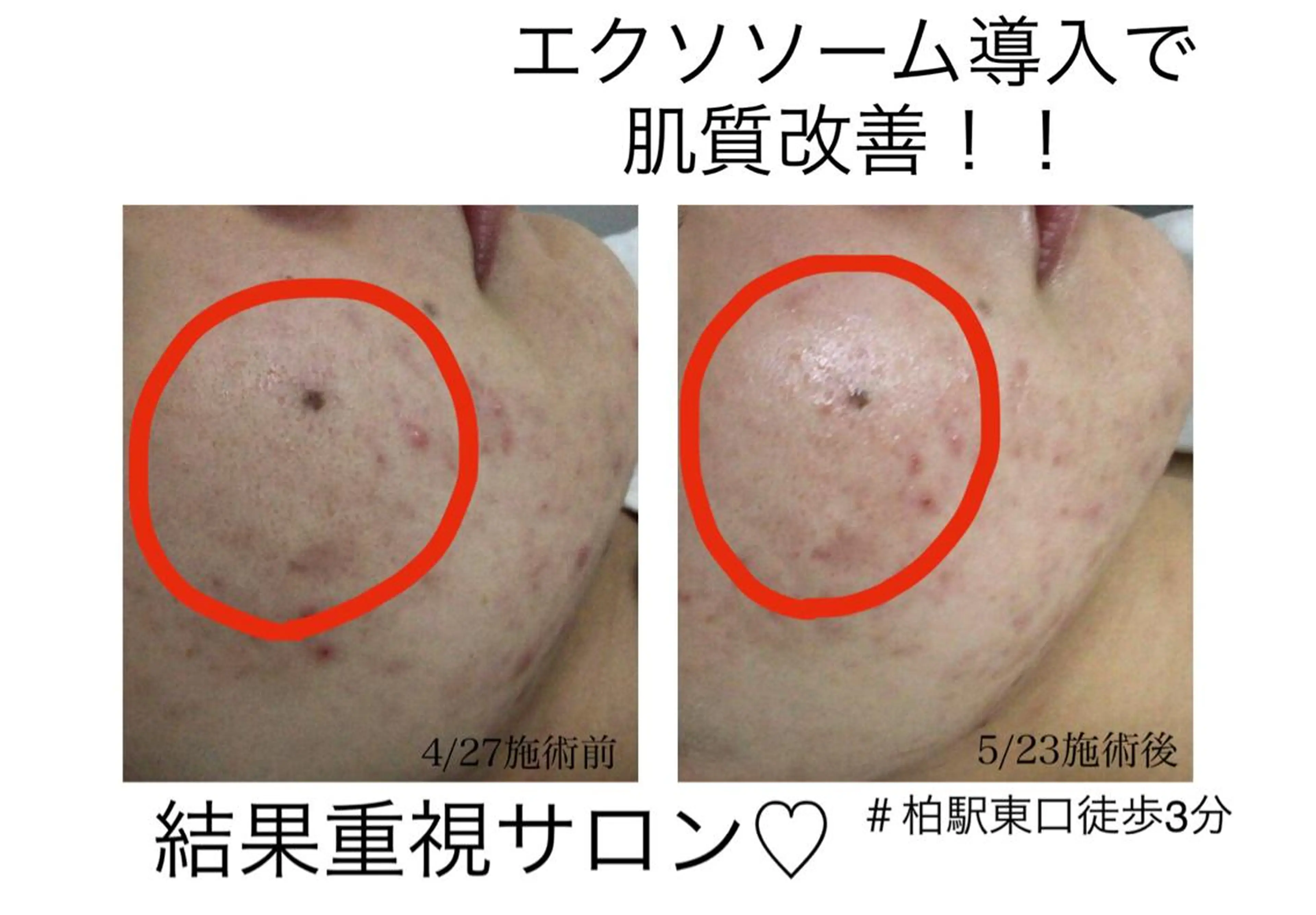 子宮矯正/腸揉み/ シュガーリング脱毛のエステ・リラクイメージ