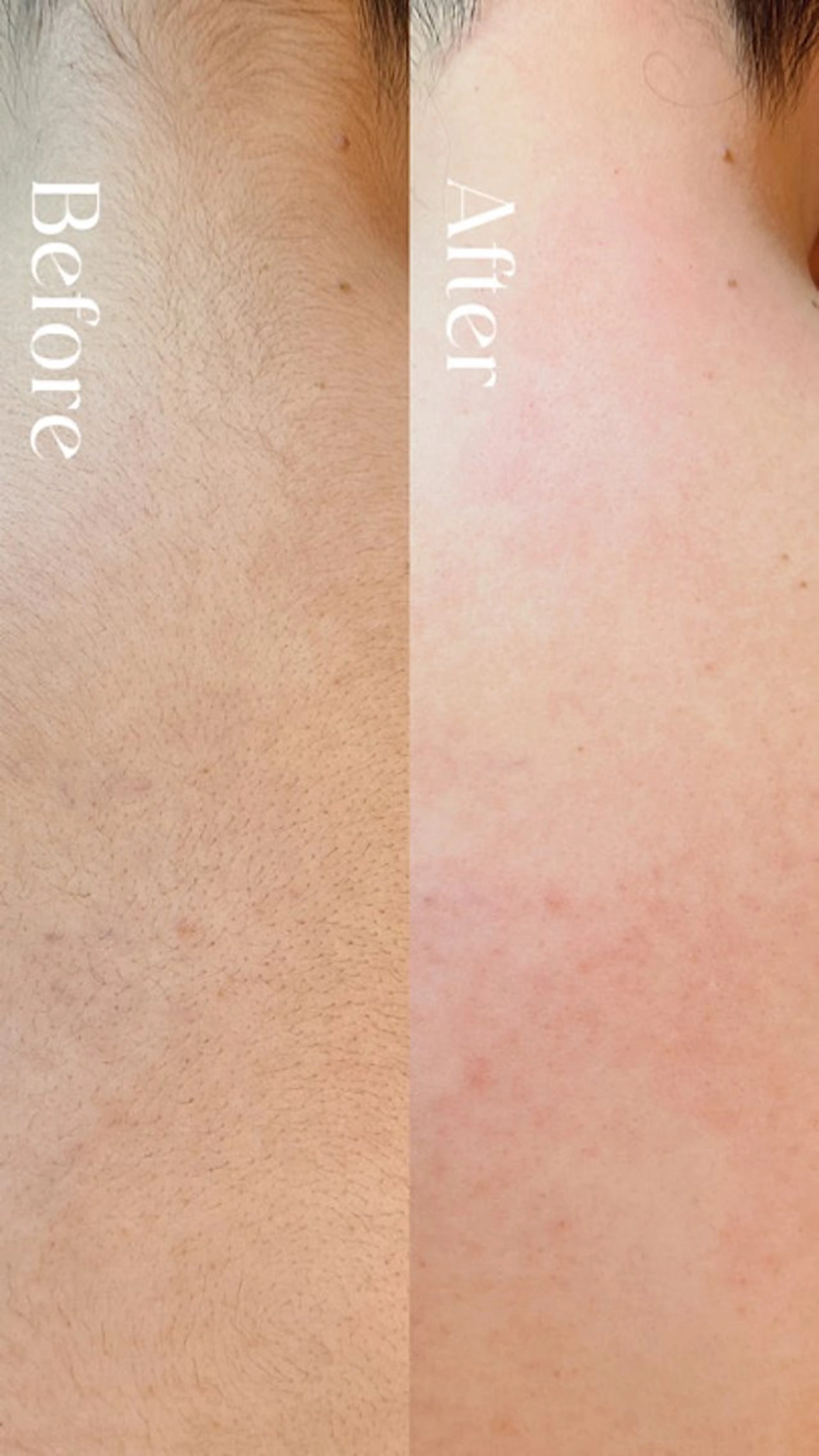 Hit. シュガーリング豊橋のエステ・リラクイメージ