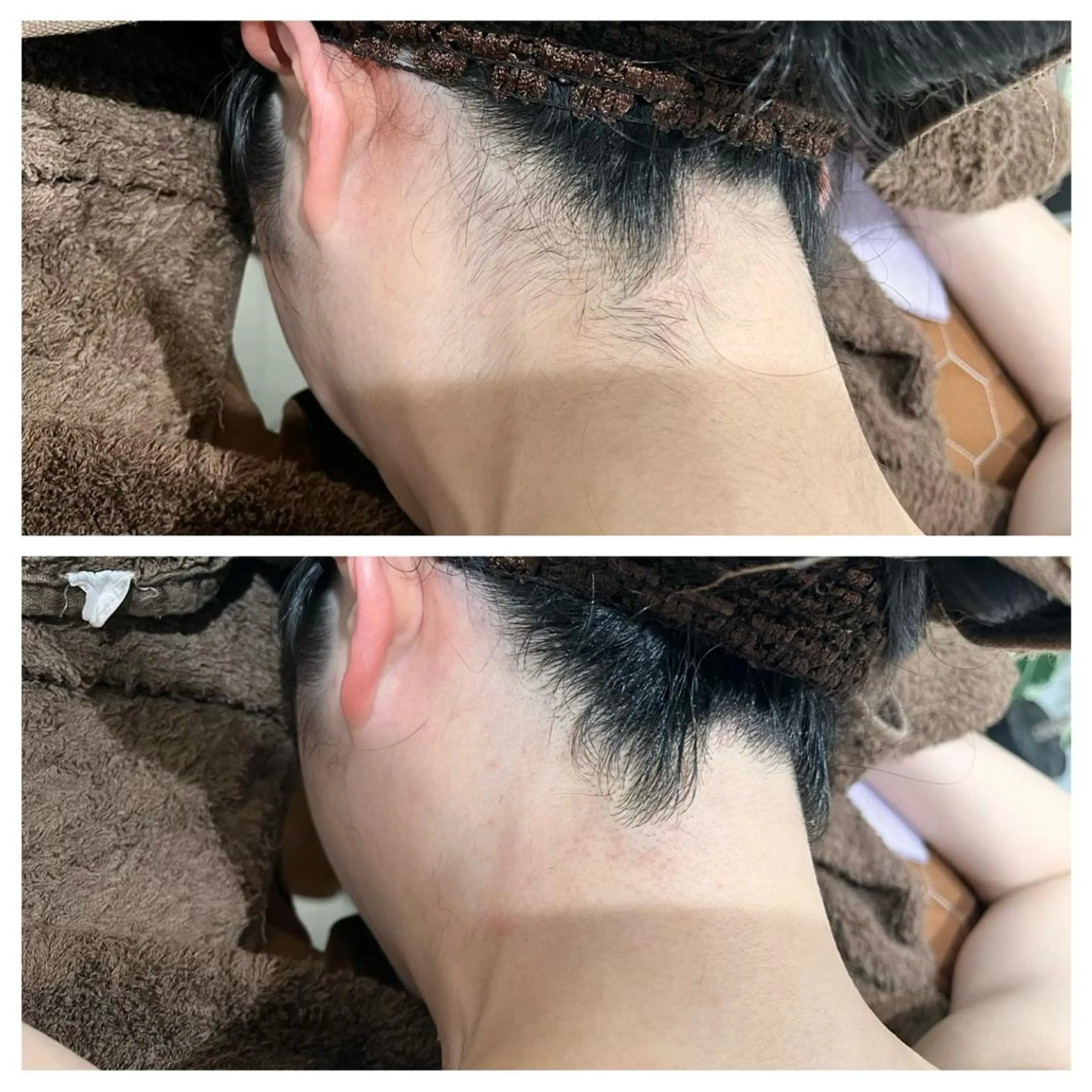 脱毛 tejina suuのエステ・リラクイメージ