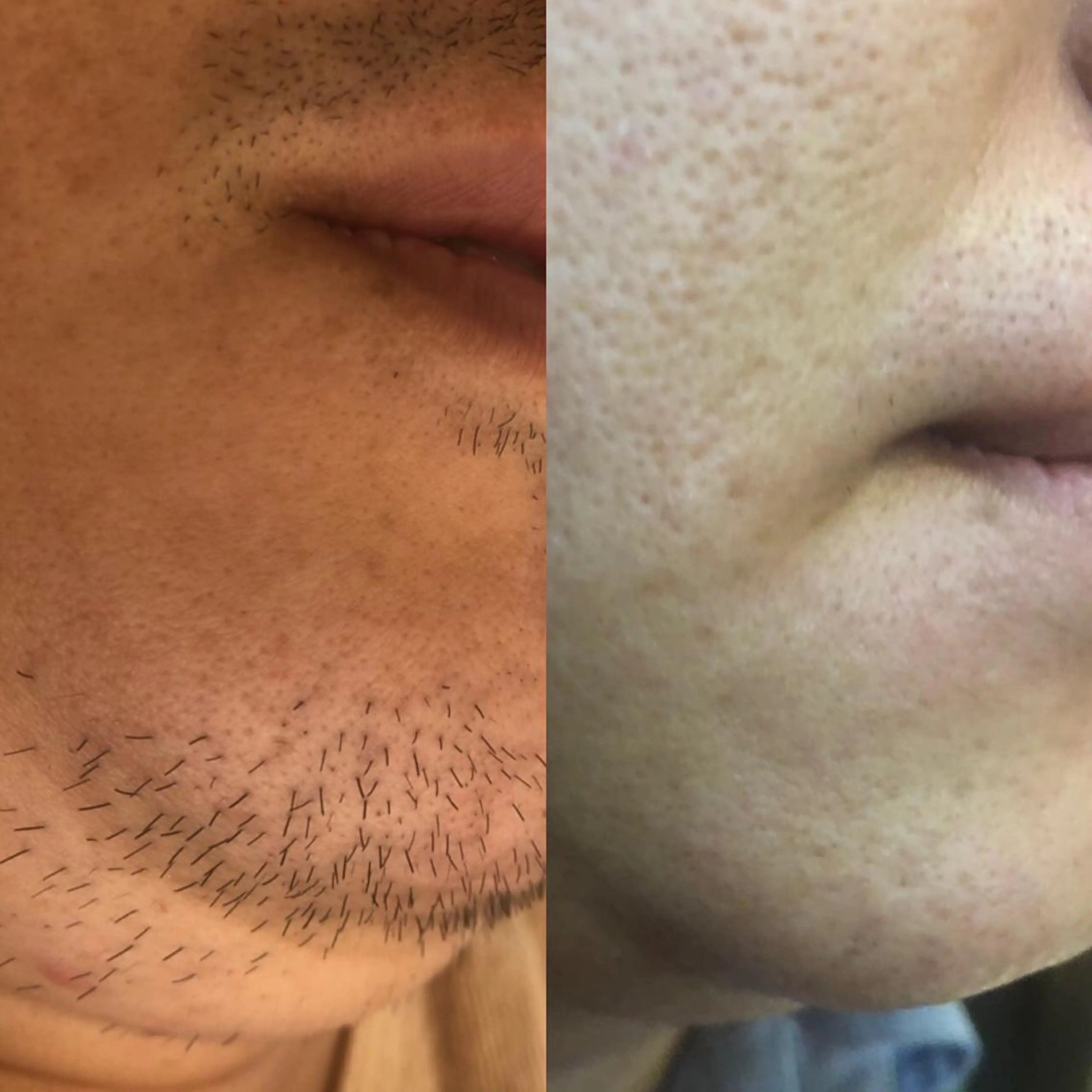 脱毛 WAX＆光脱毛/瘦身 アイブロウ/牧野亞紀の眉毛・アイブロウイメージ