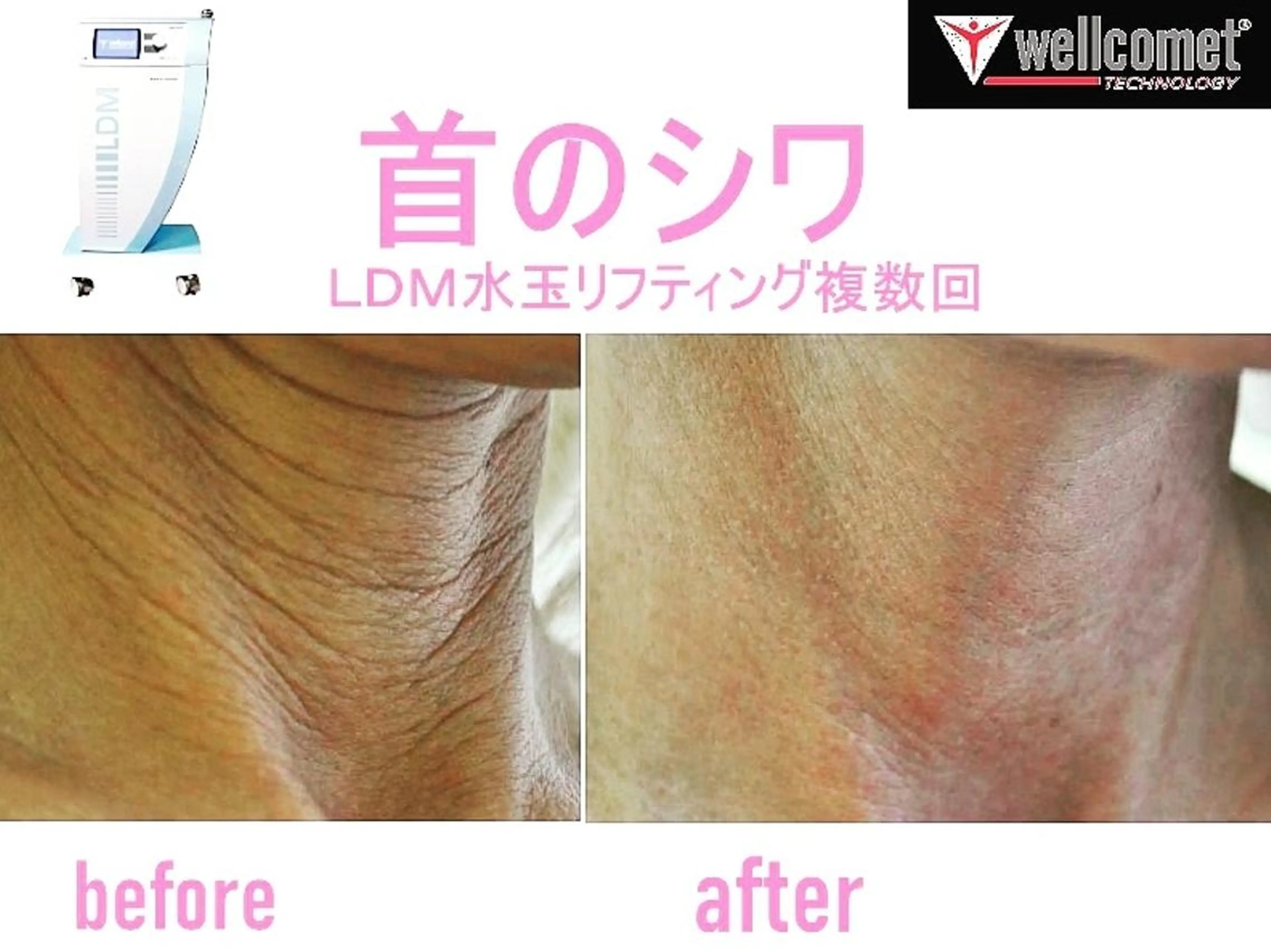 【ニキビ/肌管理】 salon varyのエステ・リラクイメージ