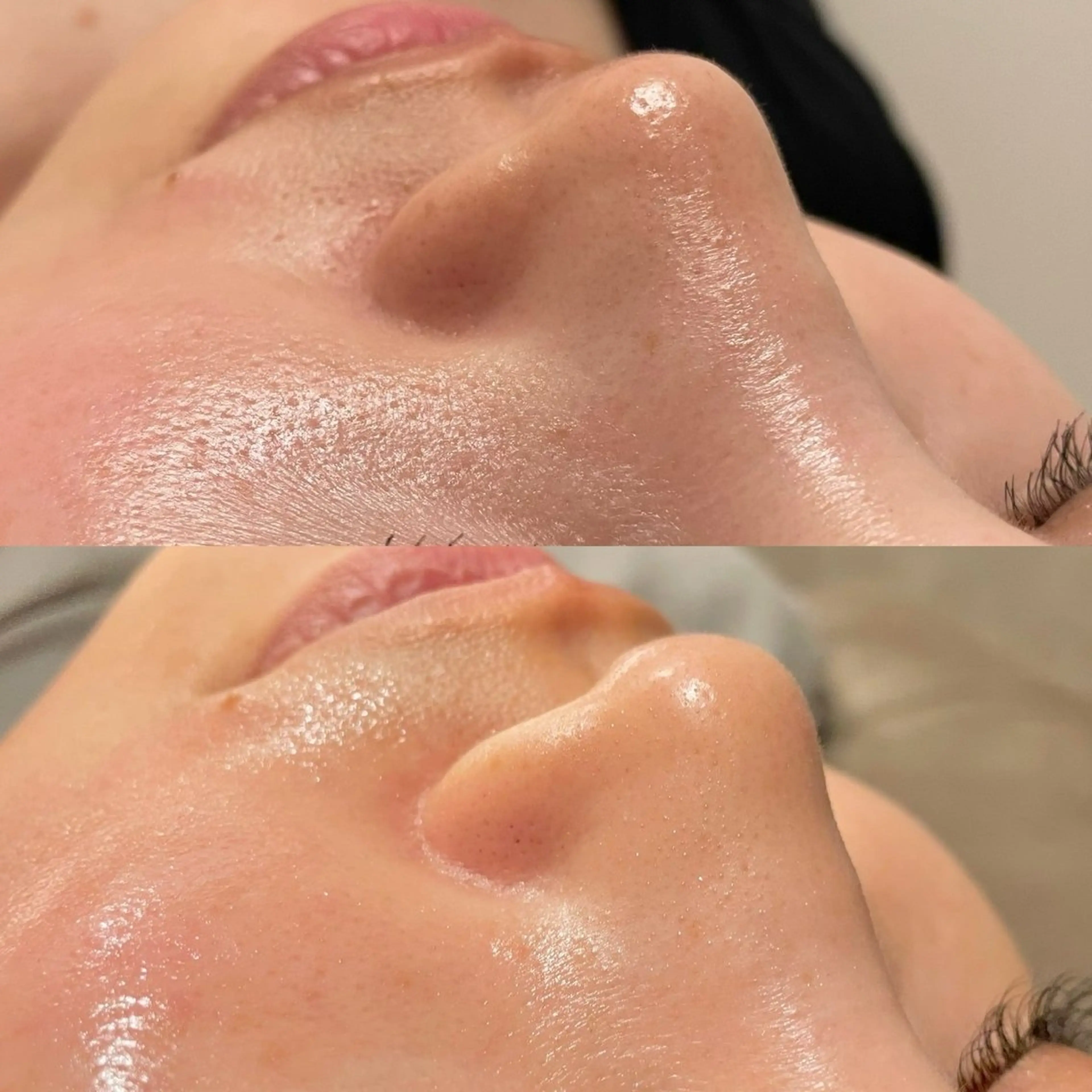 肌管理専門店Whitelabo堺東店所属・おだ あみのエステ・リラクイメージ