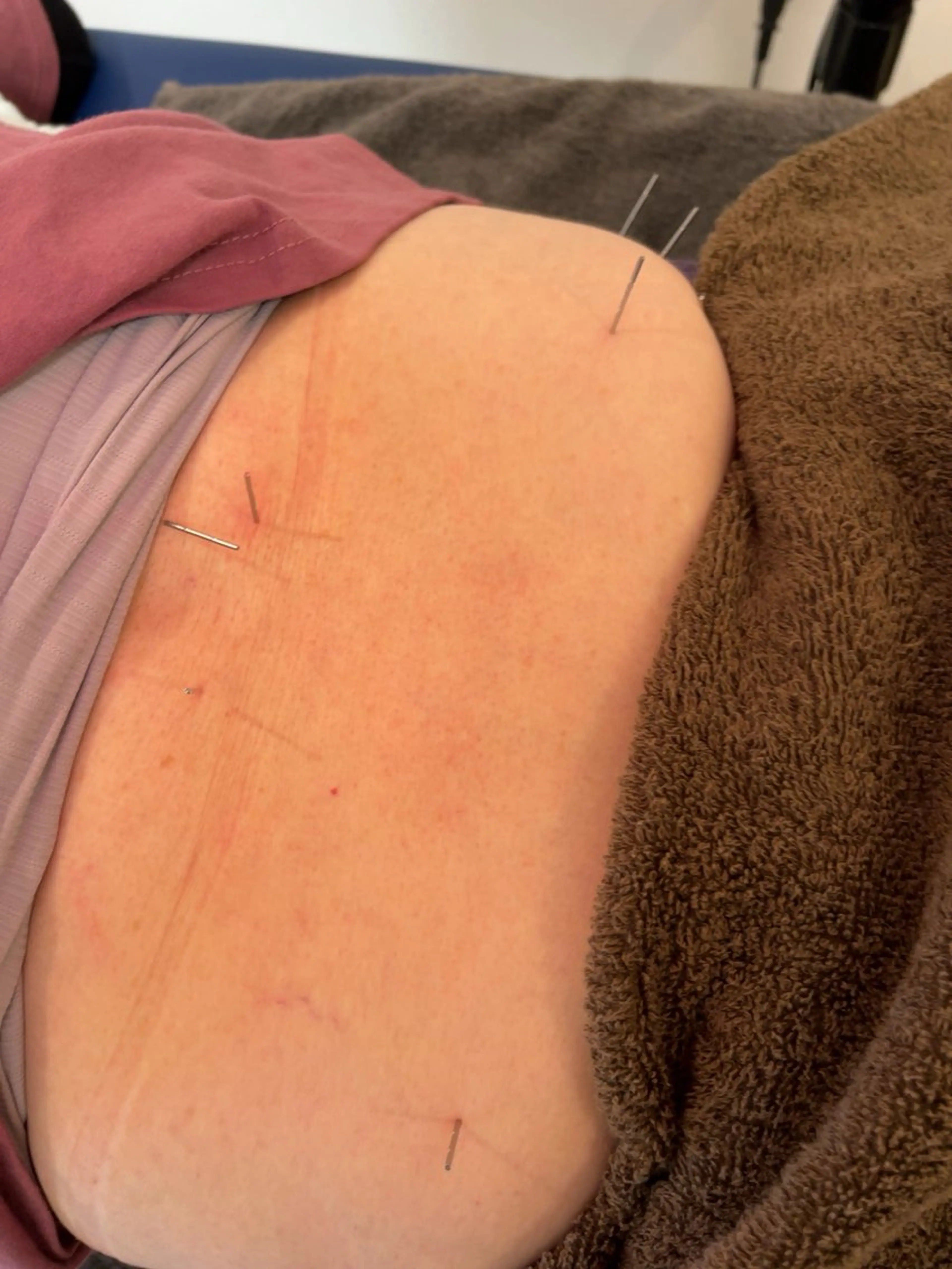 【鍼灸サロン　にった】所属・はりきゅう整体 新田鍼灸院のエステ・リラクイメージ