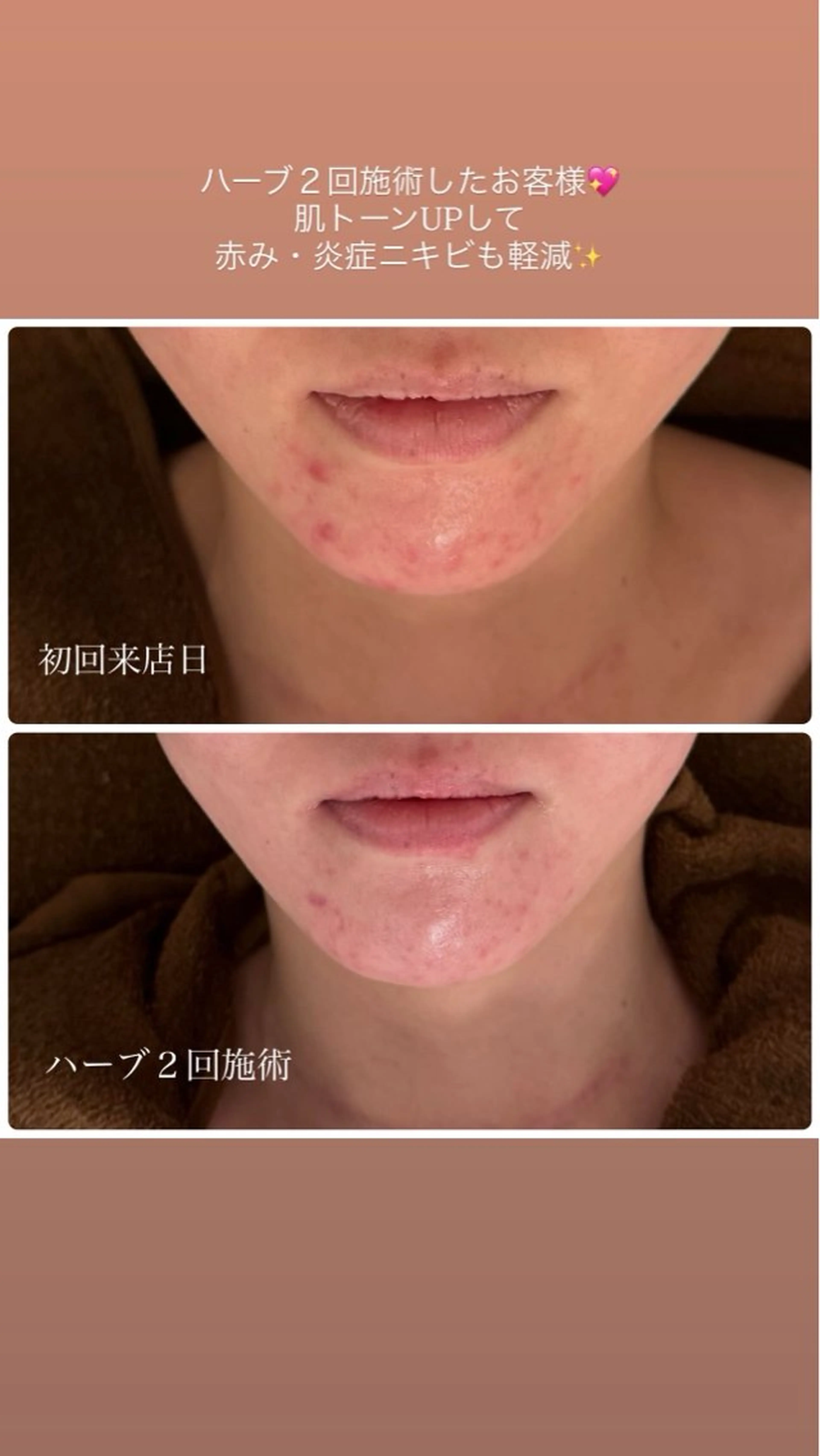 エステ 23beauty所属・武藤 那月のエステ・リラクイメージ