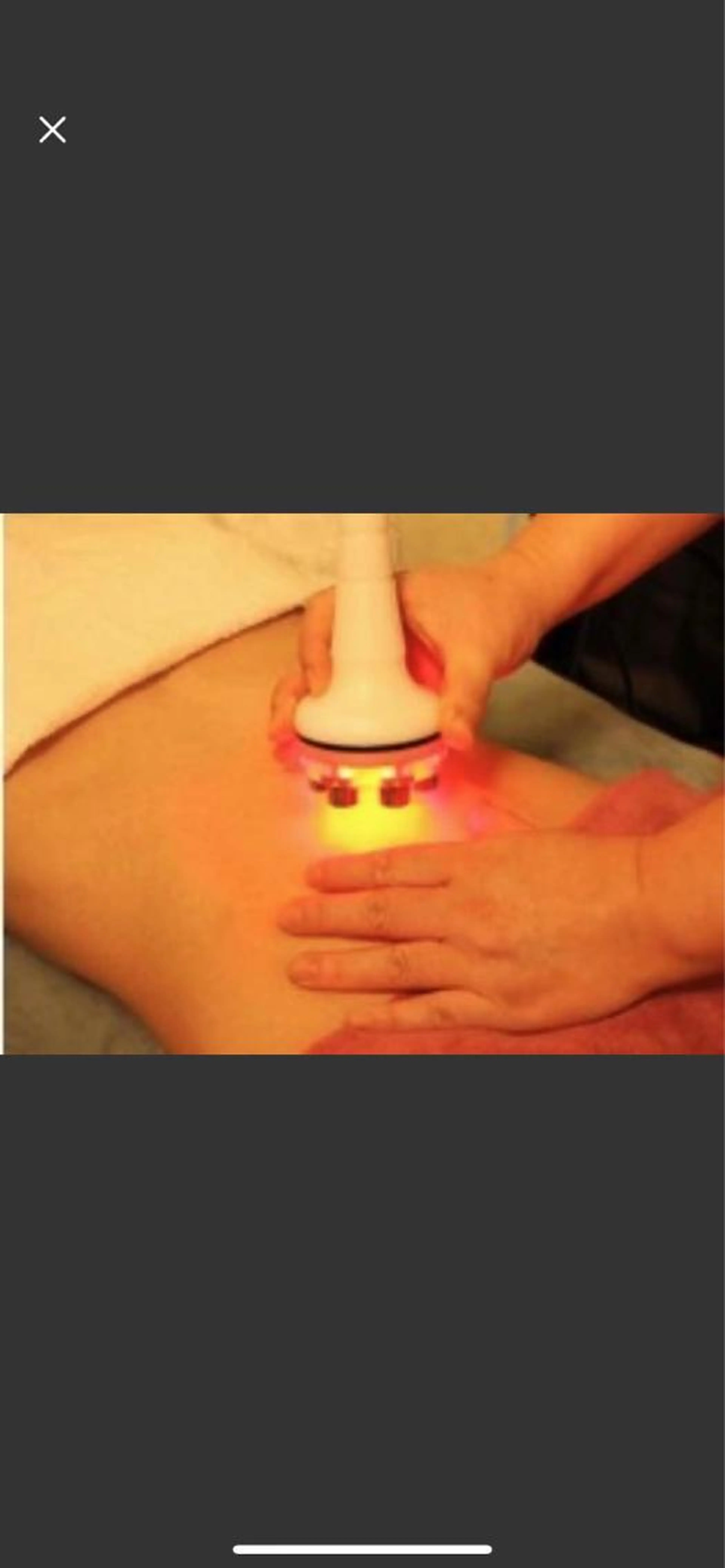 [美くびれMAKE]ハイパーナイフ/お腹コースの写真