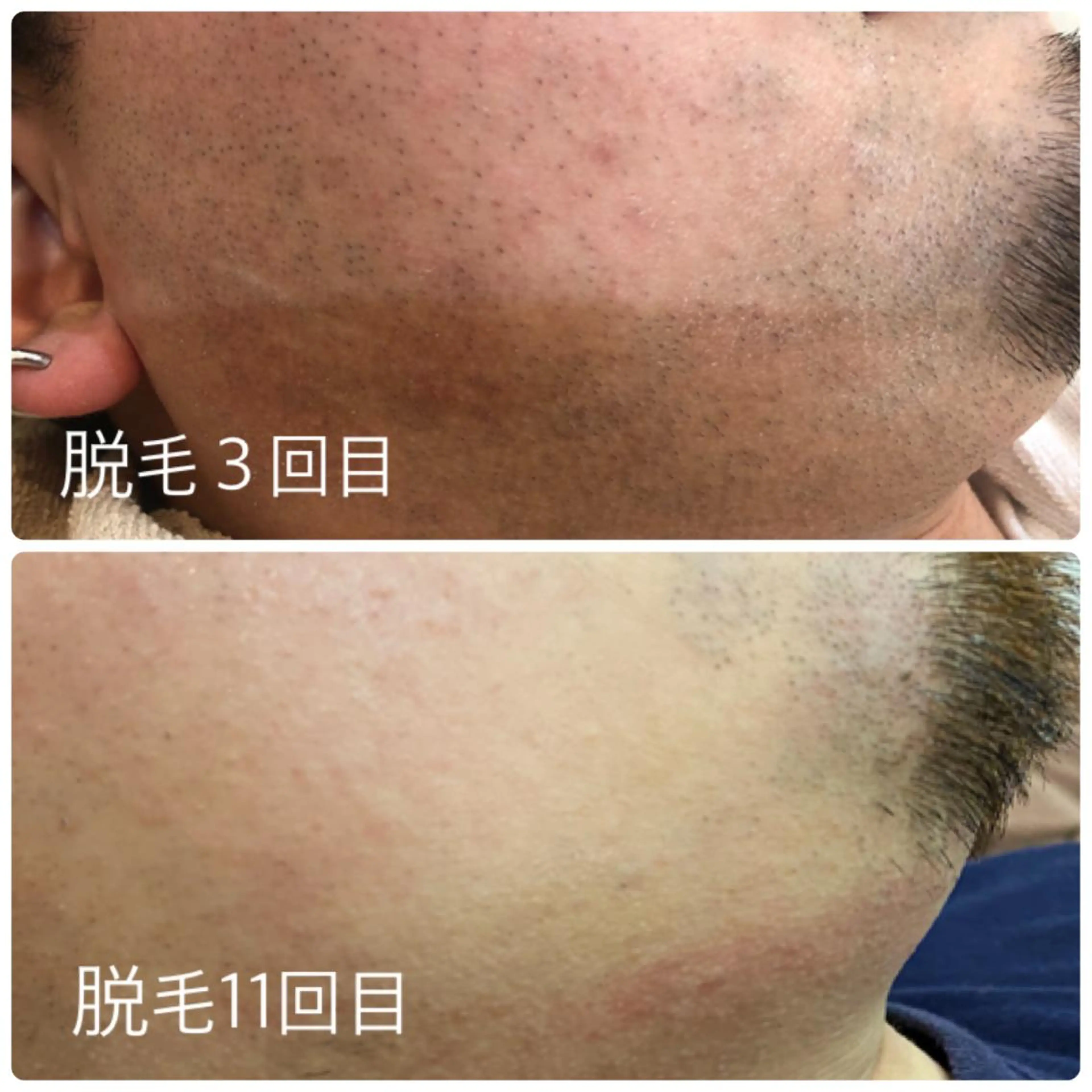 メンズ oshare tom (スタイリスト)所属・人気🌻《髪質改善》 平井 綾乃のヘアスタイル