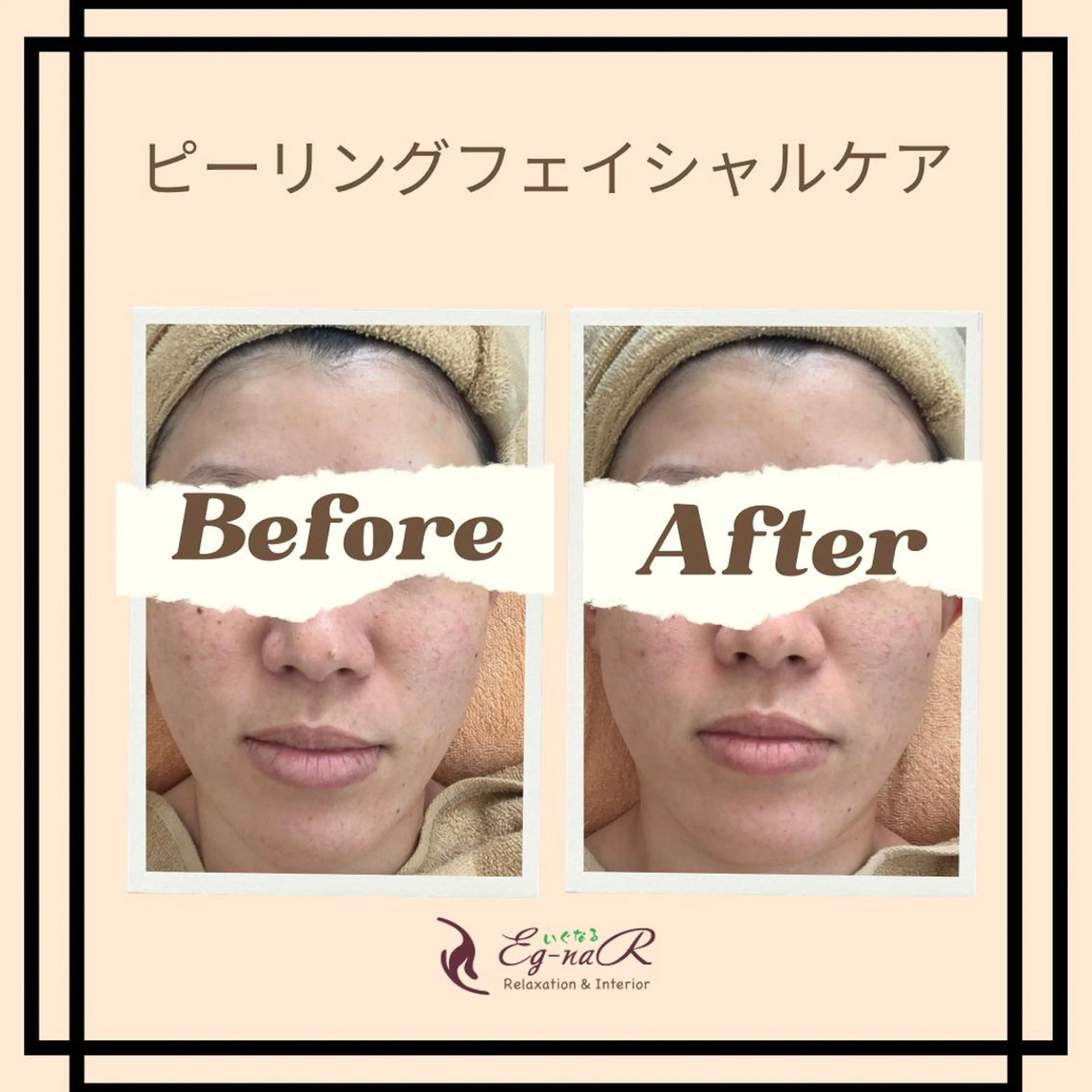 エステ エステティック&リラクゼーションサロンいぐなる所属・いぐなる 清水のエステ・リラクイメージ